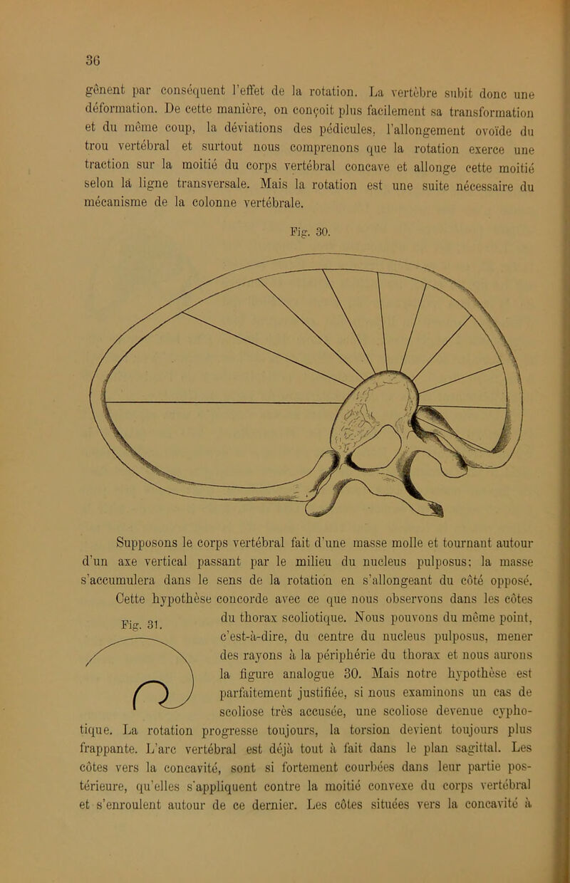 genent par conséquent l’effet de la rotation. La vertèbre subit donc une déformation. De cette manière, on conçoit plus facilement sa transformation et du meme coup, la déviations des pédicules, l’allongement ovoïde du trou vertébral et surtout nous comprenons que la rotation exerce une traction sur la moitié du corps vertébral concave et allonge cette moitié selon là ligne transversale. Mais la rotation est une suite nécessaire du mécanisme de la colonne vertébrale. Fig. 30. Fig. 31. Supposons le corps vertébral fait d’une masse molle et tournant autour d’un axe vertical passant par le milieu du nucléus pulposus; la masse s’accumulera dans le sens de la rotation en s’allongeant du côté opposé. Cette hypothèse concorde avec ce que nous observons dans les côtes du thorax scoliotique. Nous pouvons du même point, c’est-à-dire, du centre du nucléus pulposus, mener des rayons à la périphérie du thorax et nous aurons la figure analogue 30. Mais notre hypothèse est parfaitement justifiée, si nous examinons un cas de scoliose très accusée, une scoliose devenue cypho- tique. La rotation progresse toujours, la torsion devient toujours plus frappante. L’arc vertébral est déjà tout à fait dans le plan sagittal. Les côtes vers la concavité, sont si fortement courbées dans leur partie pos- térieure, qu’elles s'appliquent contre la moitié convexe du corps vertébral et s’enroulent autour de ce dernier. Les côtes situées vers la concavité à