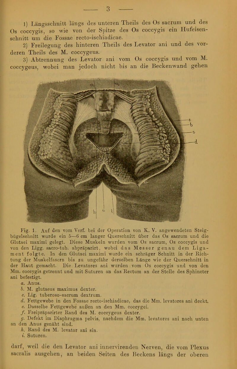 1) Längsschnitt längs des unteren Theils des Os sacruni und des Os coccygis, so wie von der Spitze des Os coccygis ein llufeisen- schnitt um die Fossae recto-ischiadicae. 2) Freilegung des hinteren Theils des Levator ani und des vor- deren Theils des M. coccygeus. 3) Abtrennung des Levator ani vom Os coccygis und vom M. coccygeus, wobei man jedoch nicht bis an die Beckenwand gehen Fig. 1. Auf den vom Verf. bei der Operation von K, V. angewendeten Steig- bügelschnitt wurde ein 5—6 cm langer Querschnitt über das Os sacrum und die Glutaei maximi gelegt. Diese Muskeln wurden vom Os sacrum, Os coccygis und von den Ligg. sacro-tub. abpräparirt, wobei das Messer genau dem Liga- ment folgte. In den Glutaei maximi wurde ein schräger Schnitt in der Rich- tung der Muskelfasern bis zu ungefähr derselben Länge wie der Querschnitt in der Haut gemacht. Die Levatores ani wurden vom Os coccygis und von den Mm. coccygis getrennt und mit Suturen an das Rectum an der Stelle des Sphincter ani befestigt. a. Anus. h. M. glutaeus maximus dexter. c. Lig. tuberoso-sacrum dextrum. d. Fettgewebe in den Fossae recto-ischiadicae, das die Mm. Icvatores ani deckt. c. Dasselbe Fettgewebe außen an den Mm. coccygei. /. Freipräparirter Rand des M. coccygeus dexter. (j. Defekt im Diaphragma pelvis, nachdem die Mm. levatores ani nach unten an den Anus genäht sind. Ti. Rand des M. levator ani sin. t. Suturen. darf, w'eil die den Levator ani innervirenden Nerven, die vom Flexus sacralis ausgehen, an beiden Seiten des Beckens längs der oberen