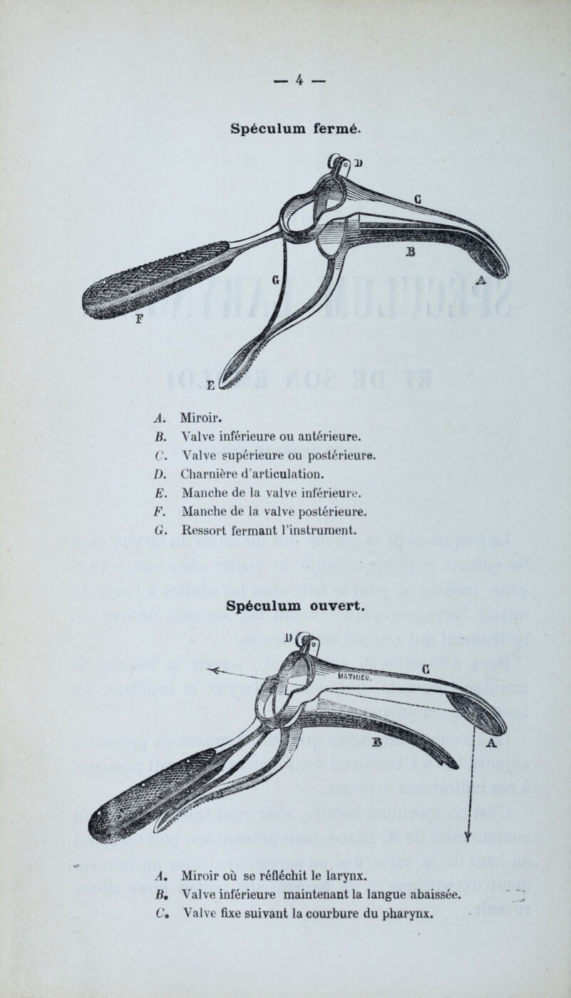 Spéculum fermé. A, Miroir où se réfléchit le larynx. B, Valve inférieure maintenant la langue abaissée. Cm Valve fixe suivant la courbure du pharynx. A. Miroir. B. Valve inférieure ou antérieure. C. Valve supérieure ou postérieure. D. Charnière d’articulation. E. Manche de la valve inférieure. F. Manche de la valve postérieure. G. Ressort fermant l’instrument. Spéculum ouvert.