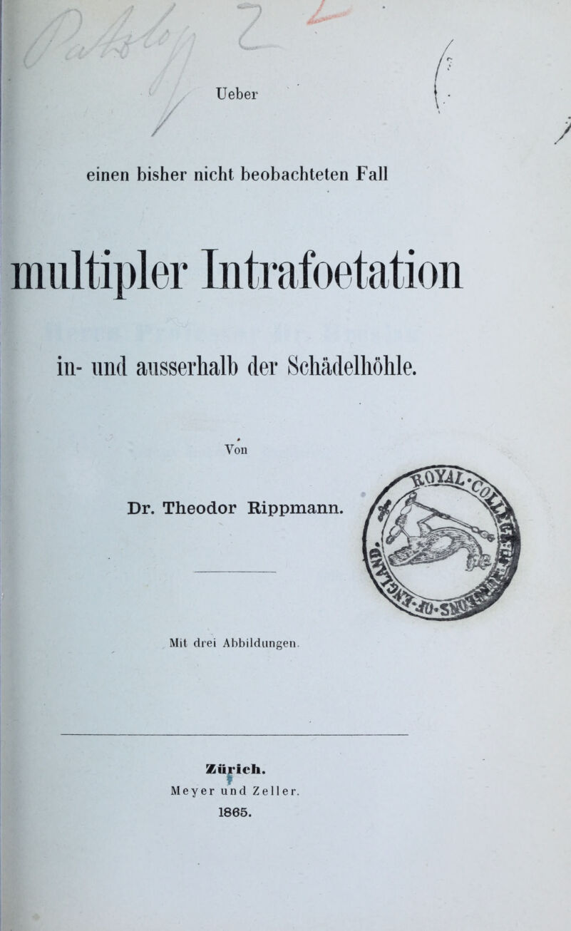 Ueber einen bisher nicht beobachteten Fall in- und ausserhalb der Schädelhöhle. Von Dr. Theodor Rippmann. Mit drei Abbildungen Zürich. Meyer und Zeller. 1865.