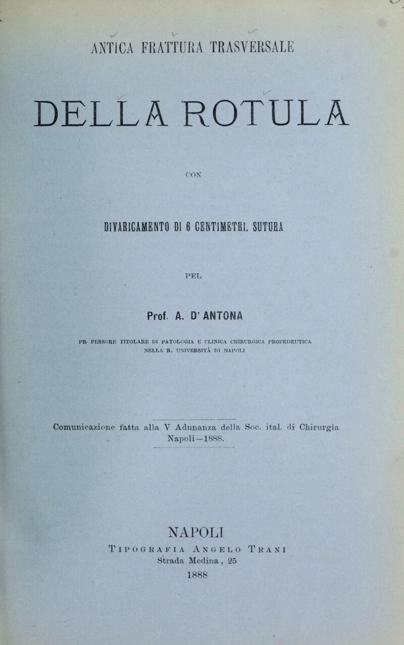 ANTICA FRATTURA TRASVERSALE DELLA ROTULA CON DIVARICAMENTO DI 6 CENTIMETRI. SUTURA PEL Prof. A. D’ANTONA PR' FESSORE TITOLARE DI PATOLOGIA E CLINICA CHIRURGICA PROPEDEUTICA NELLA R. UNIVERSITÀ DI NAPOLI Comunicazione fatta alla V Adunanza della Soc. ital. di Chirurgia Napoli —1888. NAPOLI Tipografia Angelo Tra ni Strada Medina , 25 1888