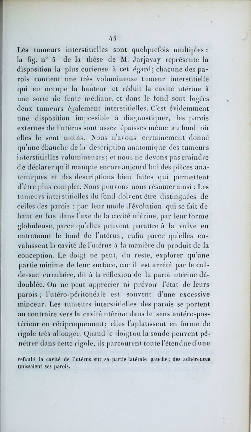 Les tumeurs interstitielles sont quelquefois multiples : la fig. n° 5 de la thèse de M. Jarjavay représente la disposition la plus curieuse à cet égard; chacune des pa- rois contient une très volumineuse tumeur interstitielle qui en occupe la hauteur et réduit la cavité utérine à une sorte de fente médiane, et dans le fond sont logées deux tumeurs également interstitielles. C’est évidemment une disposition impossible à diagnostiquer, les parois externes de l’utérus sont assez épaisses même au fond où elles le sont moins. Nous n’avons certainement donné qu’une ébauche de la description anatomique des tumeurs interstitielles volumineuses; et nous ne devons pas craindre de déclarer qu’il manque encore aujourd’hui des pièces ana- tomiques et des descriptions bien faites qui permettent d’être plus complet. Nous pouvons nous résumer ainsi : Les tumeurs interstitielles du fond doivent être distinguées de celles des parois : par leur mode d évolution qui se fait de haut en bas dans l’axe de la cavité utérine, par leur forme globuleuse, parce qu’elles peuvent paraître à la vulve en entraînant le fond de l’utérus; enfin parce qu’elles en- vahissent la cavité de l’utérus à la manière du produit de la conception. Le doigt ne peut, du reste, explorer qu’une partie minime de leur surface, car il est arrêté par le cul- de-sac circulaire, dû à la réflexion de la paroi utérine dé- doublée. On ne peut apprécier ni prévoir l’état de leurs parois ; l’utéro-péritonéale est souvent d’une excessive minceur. Les tumeurs interstitielles des parois se portent au contraire vers la cavité utérine dans le sens antéro-pos- térieur ou réciproquement; elles l’aplatissent en forme de rigole très allongée. Quand le doigt ou la sonde peuvent pé- nétrer dans cette rigole, ils parcourent toute l’étendue d’une refoulé la cavité de l’utérus sur sa partie latérale gauche; des adhérences unissaient ses parois.