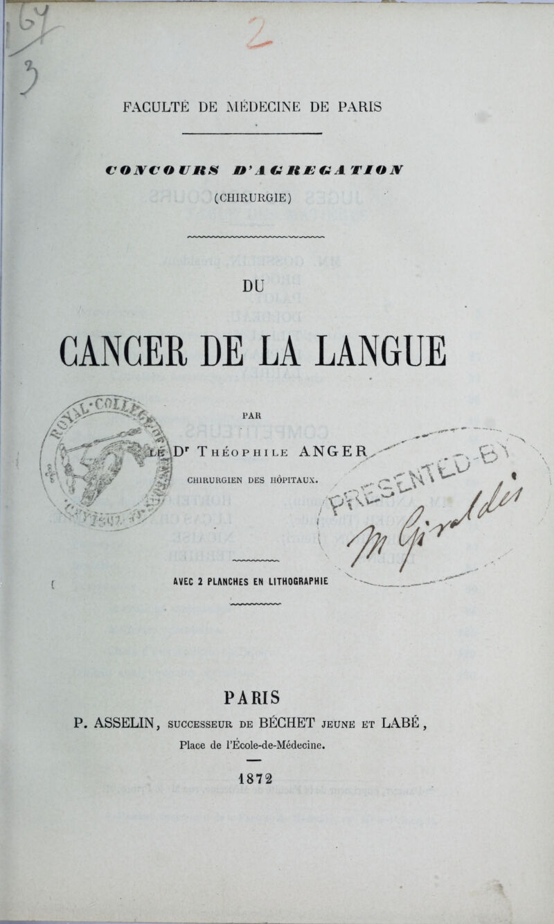 A y FACULTÉ DE MEDECINE DE PARIS C'OjyVOVHS O’ A€i A£ €1 AT MOX (CHIRURGIE) DU CANCER DE LA LANGUE A? ' % lé Dr Théophi 1 ci iKf #1 CHIRURGIEN DES HOPITAUX AVEC 2 PLANCHES EN LITHOGRAPHIE PARIS P. ASSELIN, successeur de BÉGHET jeune et LABÉ, Place de l’École-de-Médecine. 1872