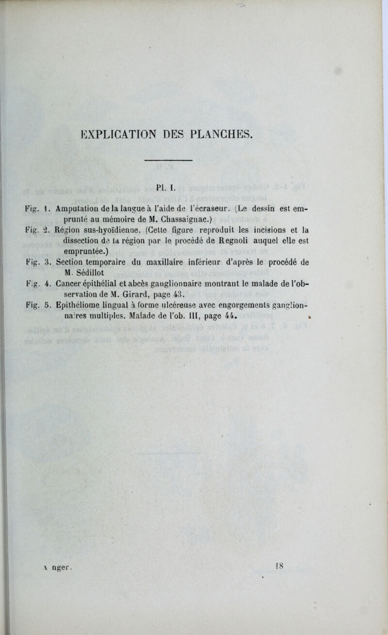 EXPLICATION DES PLANCHES. pi. i. Fig. \. Amputation delà langue à l’aide de l’écraseur. (Le dessin est em- prunté au mémoire de M. Chassaignac.) Fig. 2. Région sus-hyoïdienne. (Cette figure reproduit les incisions et la dissection de la région par le procédé de Regnoli auquel elle est empruntée.) Fig. 3. Section temporaire du maxillaire inférieur d’après le procédé de M. Sédillot Fig. 4. Cancer épithélial et abcès ganglionnaire montrant le malade de l’ob- servation de M. Girard, page 43. Fig. 5. Epithéliome lingual à forme ulcéreuse avec engorgements ganglion- naires multiples. Malade de l’ob. III, page 44. * \ nger. 18