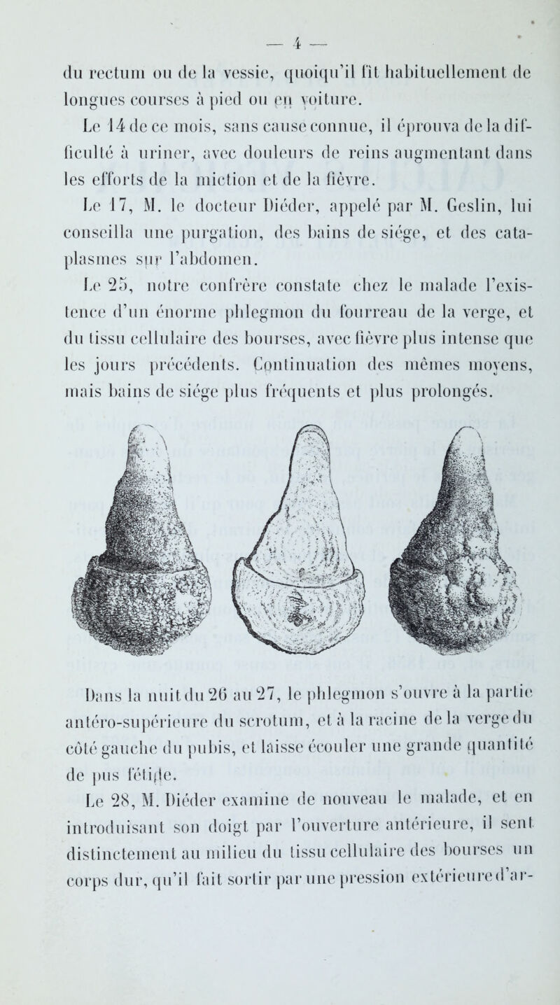 du rectum ou de la vessie, quoiqu’il fit habituellement de longues courses à pied ou en voiture. Le 14 de ce mois, sans cause connue, il éprouva de la dif- ficulté à uriner, avec douleurs de reins augmentant dans les efforts de la miction et de la fièvre. Le 17, M. le docteur Diéder, appelé par M. Geslin, lui conseilla une purgation, des bains de siège, et des cata- plasmes sur l’abdomen. Le 25, notre confrère constate chez le malade l’exis- tence d’un énorme phlegmon du fourreau de la verge, et du tissu cellulaire des bourses, avec fièvre plus intense que les jours précédents. Continuation des mêmes moyens, mais bains de siège plus fréquents et plus prolongés. Dans la nuit du 26 au 27, le phlegmon s’ouvre à la partie antéro-supérieure du scrotum, et à la racine delà verge du côté gauche du pubis, et laisse écouler une grande quantité de pus fétide. Le 28, M. Diéder examine de nouveau le malade, et en introduisant son doigt par l’ouverture antérieure, il sent distinctement au milieu du tissu cellulaire des bourses un corps dur, qu’il fait sortir par une pression extérieured’ar-