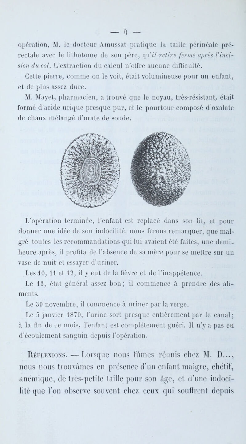 opération, M. le docteur Amussat pratique la taille périnéale pré- rectale avec le lithotome de son père, qu’?7 retire fermé après l'inci- sion du col. L’extraction du calcul n’offre aucune difficulté. Cette pierre, comme on le voit, était volumineuse pour un enfant, et de plus assez dure. M. Mayet, pharmacien, a trouvé que le noyau, très-résistant, était formé d’acide urique presque pur, et le pourtour composé d’oxalate de chaux mélangé d’urate de soude. L’opération terminée, l’enfant est replacé dans son lit, et pour donner une idée de son indocilité, nous ferons remarquer, que mal- gré toutes les recommandations qui lui avaient été faites, une demi- heure après, il profita de l’absence de sa mère pour se mettre sur un vase de nuit et essayer d’uriner. Les 10, 11 et 12, il y eut de la fièvre et de l’inappétence. Le 13, état général assez bon; il commence à prendre des ali- ments. Le 30 novembre, il commence à uriner par la verge. Le 5 janvier 1870, l’urine sort presque entièrement par le canal; à la fin de ce mois, l’enfant est complètement guéri. Il n’y a pas eu d’écoulement sanguin depuis l’opération. Réflexions. — Lorsque nous fumes réunis chez M. I)..., nous nous trouvâmes en présence d’un enfant maigre, chétif, anémique, de très-petite taille pour son âge, et d’une indoci- lité que l’on observe souvent chez ceux qui souffrent depuis