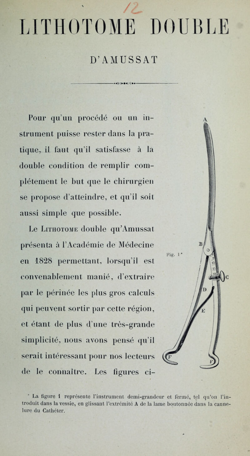 LITHOTOME DOUBLE D’AMUSSAT Pour qu’un procédé ou un in- strument puisse rester dans la pra- tique* il faut qu’il satisfasse à la double condition de remplir com- plètement le but que le chirurgien se propose d’atteindre, et qu’il soit aussi simple que possible. Le Lithotome double qu’Amussat présenta à l’Académie de Médecine en 1828 permettant, lorsqu’il est convenablement manié, d’extraire par le périnée les plus gros calculs qui peuvent sortir par cette région, et étant de plus d’une très-grande simplicité, nous avons pensé qu’il serait intéressant pour nos lecteurs de le connaître. Les figures ci- A La figure 1 représente l’instrument demi-grandeur et fermé, tel qu’on l’in- troduit dans la vessie, en glissant l’extrémité A de la lame boutonnée dans la canne- lure du Cathéter.