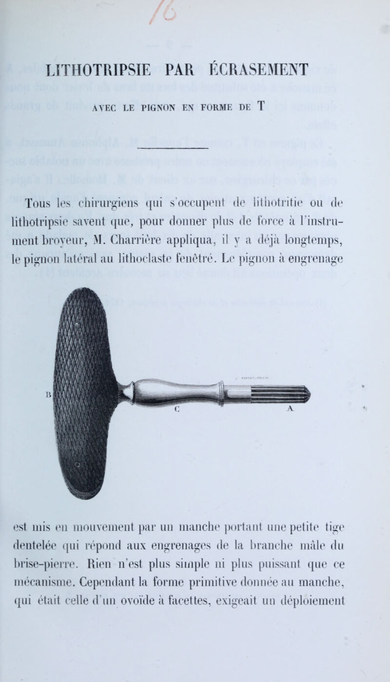 LITHOTRIPSIE PAR ÉCRASEMENT AVEC LE PIGNON EN FORME DE T Tous les chirurgiens qui s’occupent de lithotritie ou de lithotripsie savent que, pour donner plus de force à l'instru- ment broyeur, M. Charrière appliqua, il y a déjà longtemps, le pignon latéral au litlioclaste fenêtre. Le pignon à engrenage est mis en mouvement par un manche portant une petite tige dentelée qui répond aux engrenages de la branche mâle du brise-pierre. Rien n’est plus simple ni plus puissant que ce mécanisme. Cependant la forme primitive donnée au manche, qui était celle d’un ovoïde à facettes, exigeait un déploiement