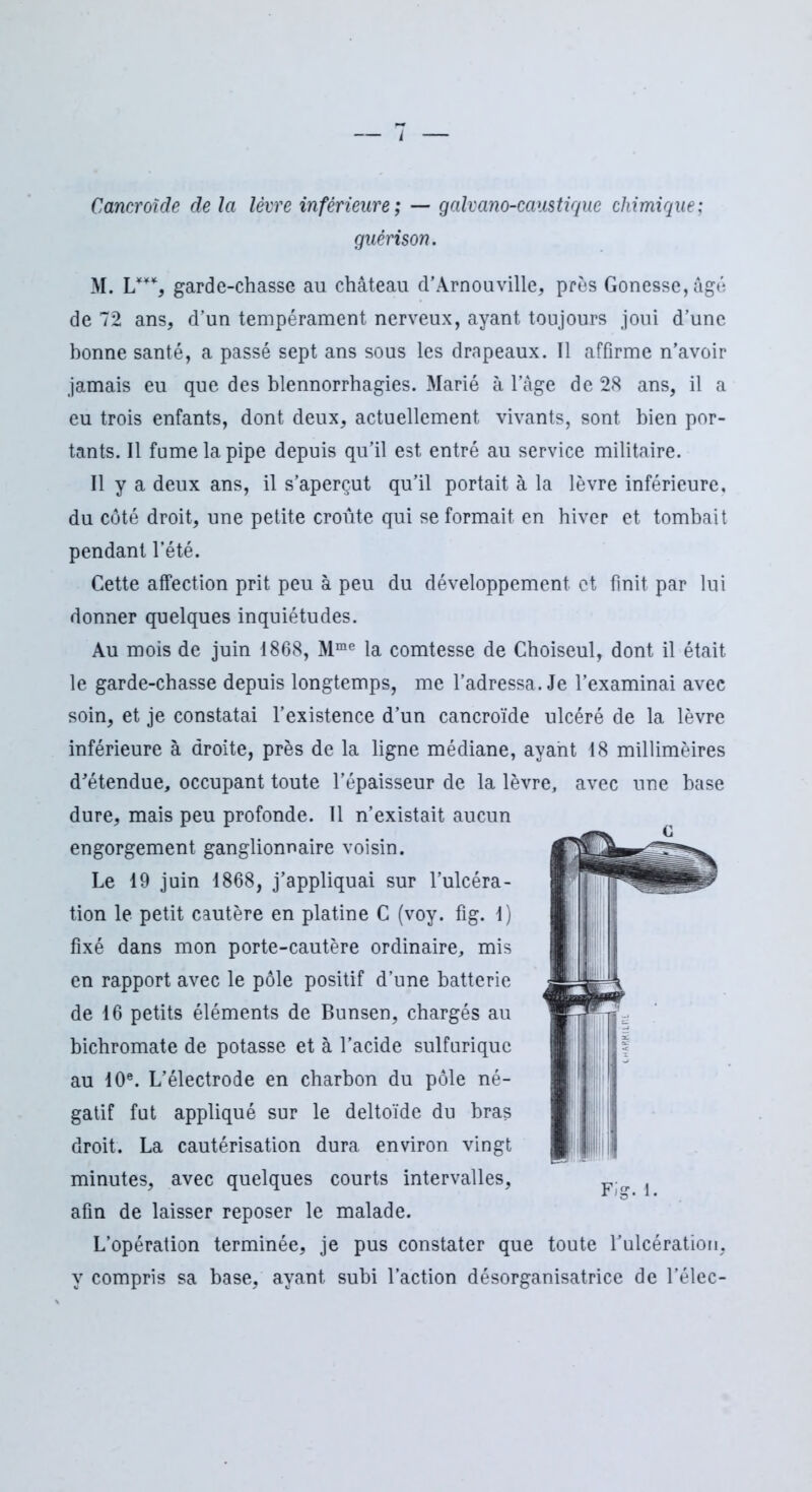 Cancroïde de la lèvre inférieure ; — galvano-caustique chimique; guérison. M. U**, garde-chasse au château d’Arnouville, près Gonesse,âgé de 72 ans, d’un tempérament nerveux, ayant toujours joui d’une bonne santé, a passé sept ans sous les drapeaux. Il affirme n’avoir jamais eu que des blennorrhagies. Marié à l’âge de 28 ans, il a eu trois enfants, dont deux, actuellement vivants, sont bien por- tants. Il fume la pipe depuis qu’il est entré au service militaire. Il y a deux ans, il s’aperçut qu’il portait à la lèvre inférieure, du côté droit, une petite croûte qui se formait en hiver et tombait pendant l’été. Cette affection prit peu à peu du développement et finit par lui donner quelques inquiétudes. Au mois de juin 1868, Mme la comtesse de Choiseul, dont il était le garde-chasse depuis longtemps, me l’adressa. Je l’examinai avec soin, et je constatai l’existence d’un cancroïde ulcéré de la lèvre inférieure à droite, près de la ligne médiane, ayant 18 millimèires d’étendue, occupant toute l’épaisseur de la lèvre, avec une base dure, mais peu profonde. 11 n’existait aucun engorgement ganglionnaire voisin. Le 19 juin 1868, j’appliquai sur l’ulcéra- tion le petit cautère en platine C (voy. fig. 1) fixé dans mon porte-cautère ordinaire, mis en rapport avec le pôle positif d’une batterie de 16 petits éléments de Bunsen, chargés au bichromate de potasse et à l’acide sulfurique au 10e. L’électrode en charbon du pôle né- gatif fut appliqué sur le deltoïde du bras droit. La cautérisation dura environ vingt minutes, avec quelques courts intervalles, afin de laisser reposer le malade. L’opération terminée, je pus constater que toute l’ulcération, y compris sa base, ayant subi l’action désorganisatrice de l’élec-