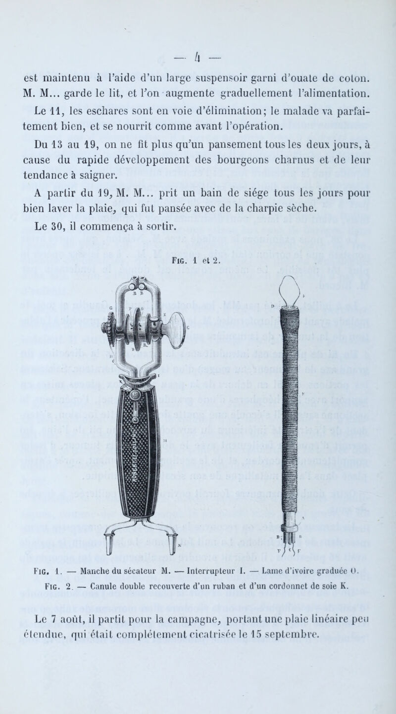 h est maintenu à l’aide d’un large suspensoir garni d’ouale de colon. M. M... garde le lit, et Ton augmente graduellement l’alimentation. Le 11, les eschares sont en voie d’élimination; le malade va parfai- tement bien, et se nourrit comme avant l’opération. Du 13 au 19, on ne fit plus qu'un pansement tous les deux jours, à cause du rapide développement des bourgeons charnus et de leur tendance à saigner. A partir du 19, M. M... prit un bain de siège tous les jours pour bien laver la plaie, qui fut pansée avec de la charpie sèche. Le 30, il commença à sortir. Fig. 1 et 2. Fig. 1. — Manche du sécateur M. — Interrupteur I. — Lame d’ivoire graduée O. Fig. 2. — Canule double recouverte d’un ruban et d’un cordonnet de soie K. Le 7 août, il partit pour la campagne, portant une plaie linéaire peu étendue, qui était complètement cicatrisée le 15 septembre.