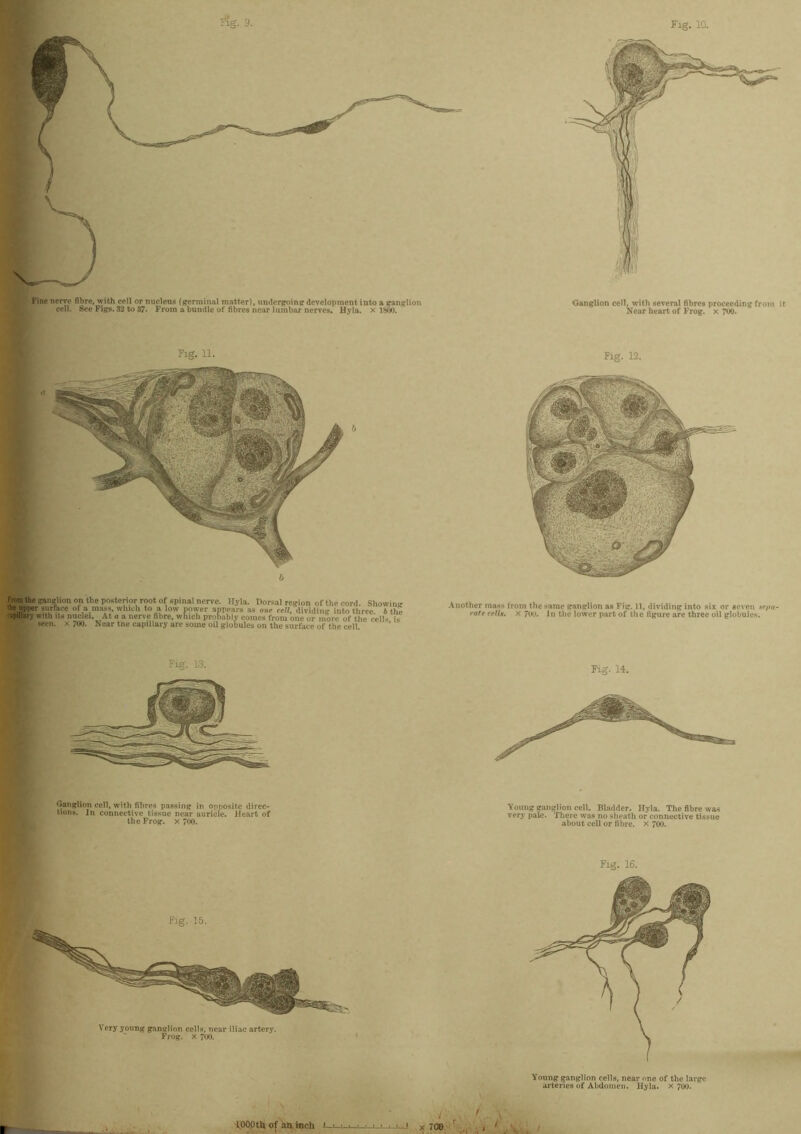 From the ganglion on the posterior root of spinal nerve. Hyla. Dorsal region of the cord. Showing of.a.mafS, which to a low power appears as one cell, dividing into three, b the apulary with its nuclei. At a a nerve fibre, which probably comes from one or more of the celN is ( wen. x TOO. Near tne capillary are some oil globules on the surface of the cell. Another mass from the same ganglion as Fig. 11, dividing into six or seven se/ia- rate cells, x 7uu. In the lower part of the figure are three oil globules. Fig. 13. ganglion cell, with fibres passing in opposite direc- tions. In connective tissue near auricle. Heart of the Frog, x 700. Fig. 14. Young ganglion cell. Bladder. Hyla. The fibre was very pate. There was no sheath or connective tissue about cell or fibre, x 700. Fig. 16. Young ganglion cells, near one of the large arteries of Abdomen. Hyla. x 700. i x 700 /