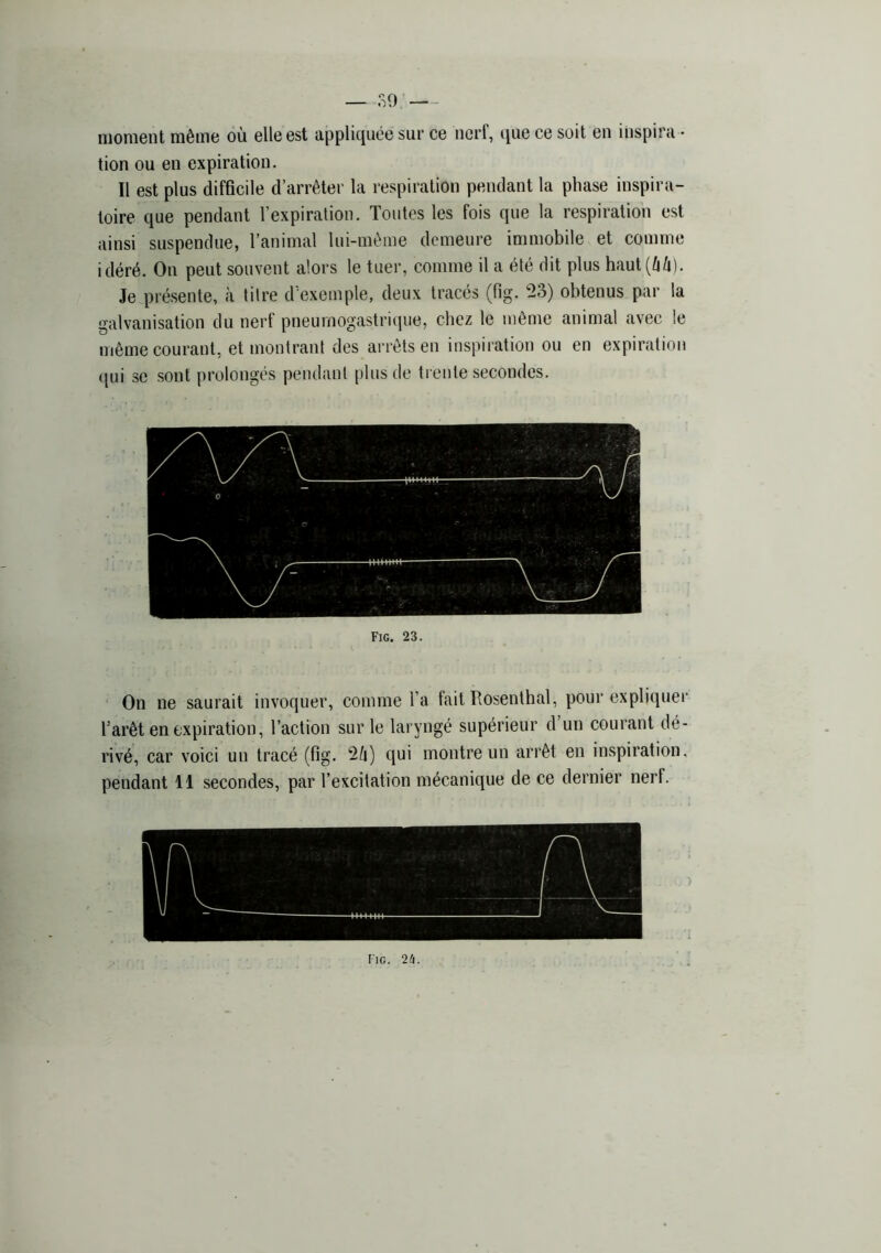 — —- moment même où elle est appliquée sur ce nerf, iiue ce soit en inspira - tion ou en expiration. Il est plus difflcile d’arrêter la respiration pendant la phase inspira- toire que pendant l’expiration. Toutes les fois que la respiration est ainsi suspendue, l’animal lui-même demeure immobile et comme idéré. On peut souvent alors le tuer, comme il a été dit plus haut(fi/i). Je présente, à titre d’exemple, deux tracés (fig. 23) obtenus par la galvanisation du nerf pneumogastrique, chez le même animal avec le même courant, et montrant des arrêts en inspiration ou en expiration ([ui SC sont prolongés pendant plus de trente secondes. Fig. 23. On ne saurait invoquer, comme l’a fait Rosenthal, pour expliquer l’arêt en expiration, l’action sur le laryngé supérieur d un courant dé- rivé, car voici un tracé (fig. 2/i) qui montre un arrêt en inspiration, pendant 11 secondes, par l’excitation mécanique de ce dernier nerf. Fie. 24.