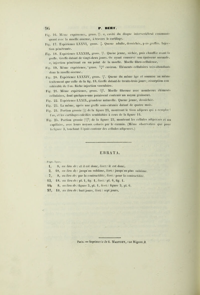 Ki '. IC. Même expérience, gros?. a, cavité du disque intervertébral communi- quant avec la moelle osseuse, à travers le cartilage. Fig. 17. Expérience LXXVI, gross. {.Queue adulte, desséchée, p iis greffée. Injec- tion pénétrante. Fig. 18. Expérience LXXXI1I, gross. Queue jeune, séchée, puis chauffée avant la «refle. Greffe datant de vingt-deux jours. Os ayant conservé son épaisseur normale. «, injection pénétrant en un point de la moelle. Moelle fibro-cellulcuse. Fiir. 19. Même expérience, * gross. environ. Eléments cellulaires très-abondants dans la moelle osseuse. Eig. 20. Expérience LXXX1V, gross. Queue du même âge et soumise au même traitement que celle de la fig. 18. Greffe datantde trente-trois jours ; résorption cou sidérable de l'os. Riche injection vasculaire. Fig. 21. Même expérience, gross. Moelle fibreuse avec nombreux éléments cellulaires, dont quelques-uns paraissent contenir un noyau graisseux. Fig. 22. Expérience LXXIX, grandeur naturelle. Queue jeune, desséchée. Fig. 23. La même, après une greffe sous-cutanée datant de quatre mois. Fig. 24. Portion grossie (f) delà figure 23, montrant le tissu adipeux qui a remplacé l'os, et les cartilages calcifiés semblables à ceux de la figure 14. Fig. 25. Portion grossie (^) de la figure 23, montrant les cellules adipeuses et un capillaire, avec leurs noyaux colorés par le carmin. (Même observation que pour la figure 3, touchant l’épais contour des cellules adipeuses.) E F RATA. Page, ligne. 1, 8, au lieu de : et il est donc, lisez: il est donc. 2, 10, au lieu dç: jusqu’au sublime, lisez: jusqu’au plus sublime. 7, 8, au lieu de : par la contractilité, lisez : pour la contractilité. 12, 18, au lieu de : pl. 1, fig. 1, lisez: pl. 6, fig. 1. 48; 8, au Heu de: figure 3, pl. 1, lisez : figure 3, pl. G. 57, 10, au lieu de : huit jours, lisez : sept jours. Paris. — Imprimerie de E. Martinet, nie Mignon,2.