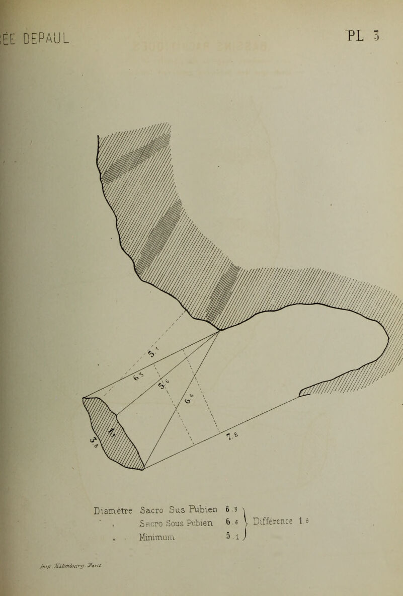 Diamètre Sacro Sus Pubien „ Sacro Sous Pubien „ Minimum 6 .3 \ 6.6 \ Différence 1 = 5 i J jvip. 'Xa-limldUry T’jtris