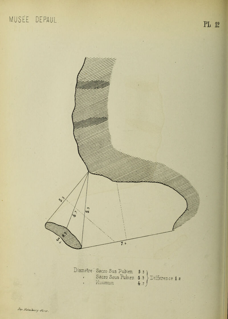Diamètre Sacro Sus Pubien 5.3 ï * Sacro Sous Pubien 5 .9 > Différence 1e » Minimum k.i PL 12 ^ Jfàrnimty .