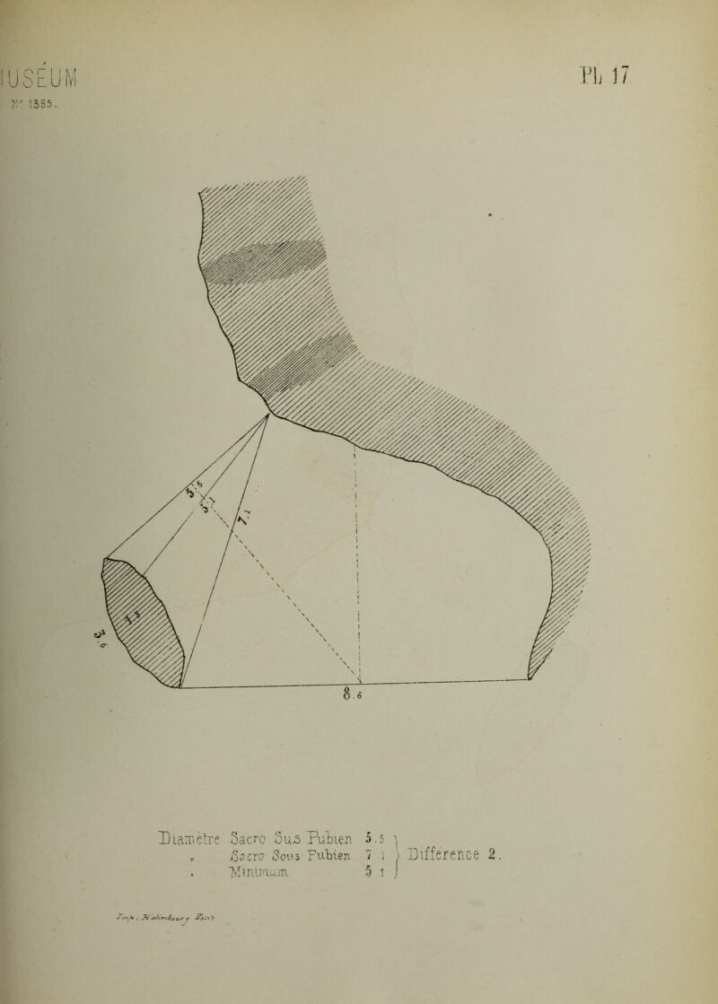 Diamètre Sacro Su5 Pubien 5.5 \ „ 8 a cio Sons Pubien 7 î Différence 2 , Minimum 5 a ) y >7th . AM afiniiour ?
