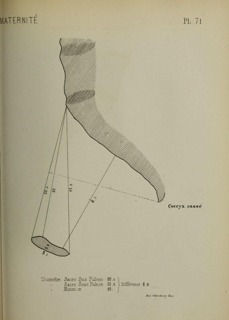 MATERNITÉ Coccyx casse ! Diamètre Sacro Sus Pubien 40.u \ Sacro Sous Pubien 11, l l Différence \ â ./ Einimun 10, Jrrtp. yfÀïtmiovrc) ?^r,s