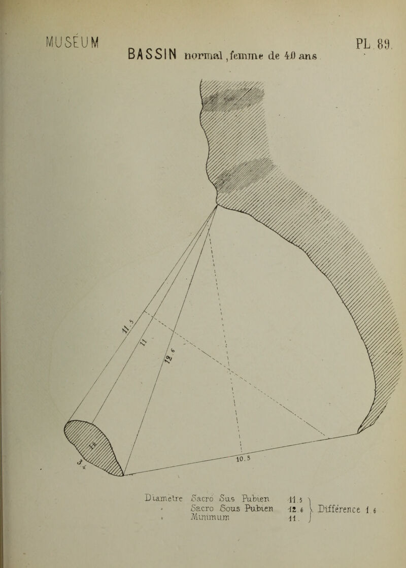 BASSIN normal, femme de 41) ans Diamètre 5acro jSuç Pubien * Minimum 41.5 1