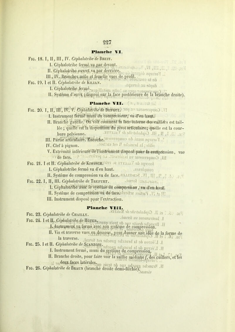 Planche VI. Fig. 18. I, II, III, IV. Céphalotnbe'de Breit. I. Céphalotribe fermé,vp ,ppr devant. II. Céphalotribe ouvert vu par derrière. III, IV. .Bruncfiçs màle pt t'emelle vues de profil. Fig. 19. I et II. Céphalotribe de Kilia>\ I. Cephalolj#^.^,^ aJiü;: fia .,.r/ i... ; 0 r II. Système, d’aiçrêj, (dispos^,;Sur la f^\ce postérieure de la branche droite). v ^ ' * ... vJw- - ''■•*•3 ^ Planche VII. Fig. 20. I, II, ffi) ïV;!f: tftytâîikiéllfèlhtmtè raaaaaïqffHO .71 I. Instrument fVritf^MiHrd'n dtotrifiheâsehh'/Vn d%i haut. II. Branché gatà^Hel1C^ii-SûiFÉ*colmtli’éWf la fade1 interne des'ittuilleî’s est tail- lée; quétl^est ’h'disposition du pivot articulaire; quelle est la cour- bure pelvienne. -11 ' J-u ^ a<Jï'*lo$odqàO .III t II . r: III. PàrtTé',aftac\&aiiJét'Fhédcier.'0^zsiqmoo r,f. irnim gijeqao'I r IV. Clef à pignon. V. Extrémité inférieuiW'dêdhiMfhmertfdlfepô^Jpoürjliaecoiripression, vue de face. P «Bïdhsîj sJ Jasoêicai or luaægnjmoO JH Fig. 21. I et II; Céphalotribe de KiwfôeH. •' 6b ; . ! , I. Céphalotribe fermé vu d’en haut. •aâzofqmov II. Système de compression vu de face.najjznn.i' n Fig. 22. I, II, III. Céphalotribe de Trefurt. mam'l I. Céphalotrib'é ’dil^é' Ie 'fèfné de compression , vu dlerv haut. II. Système de compréSsiôiVVii 'êd'fà&éi'fijcdhe mij ndi . y }r III. Instrument disposé pour l’extraction. Planche VIII. Fig. 23. Céphalotribe de Chailly. Fig. 24.1 et U,,Céphalotribe de Hüj'er, . -,J/ Jn9annJenI .1 TrT f • -• ; H '-VùWBOp 81011 9b 9117 ôlioib SdoiïBlS II I. In$trpmei)t vu, ferme avec .son système de compression. II. Vis H traverse mes m fteous, ,1'oul-,donner une lie d» la Jornie de la traverse. . , , io.njai.oi .311 - ok t ht r ■ i ; , t , -S™ ^ 9dûüfi§ odonsad si 9b noaoà'J I Fig. 2o. I et II. Lephalotnbe de Sçanzqni. T , „ J/SVi J,:C 9flOI)BB âdonr/id cl ofi rffmVT FT I. Instrument ferme, muni du systèjnq dp, çom^ressTdd. 't II. Branche droite, pour faire voir la saillie médiane f, des cuillers, et les deux faces latérnlpc .^filml elTifiOoI-etpaio. Fig. 26. 128 » .Bfinoiv