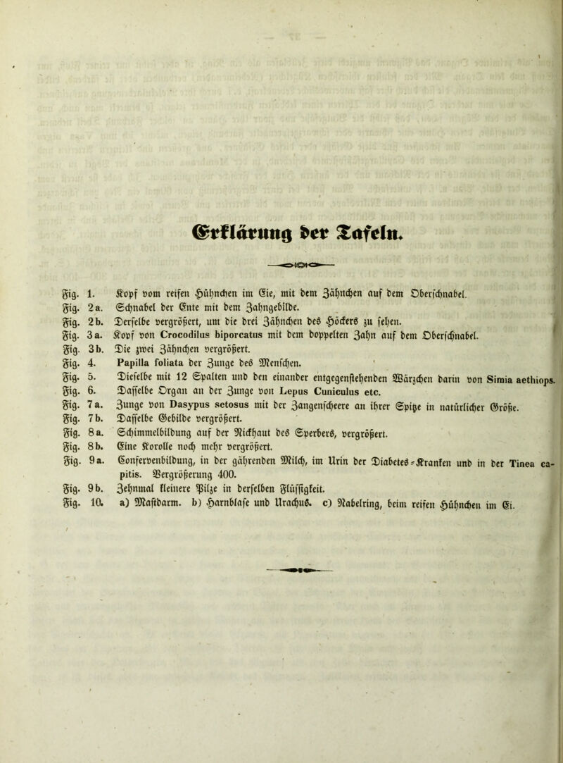 gig- gig- gig- gig- gig- gtg- gig- gig- gig- gig- gig- gig- gig- gig- gig- / 7'i ,r Crrftärung Xofcln. 1. topf »om reifen £mhncben im (Sie, mit bem 3äfynd)<m auf bem Oberfcpnabel. 2 a. Schnabel ber (Sitte mit bem 3<ri)ngebilbe. 2 b. 2)erfelbe »ergröpcrt, um bte brei 3äf)nchen beö |)bcferö ju feigen. 3 a. topf oon Crocodilus biporcatus mit bem hoppelten 3al)n auf bem Oberfdjnabel. 3 b. 2)ie jroei 3äf)n<hw oergröpert. 4. Papilla foliata ber 3unge beb 9D?cnfchen. 5. 3)iefelbe mit 12 Spalten unb ben einanber entgegenfie^enben SBärjchen barin »on Siraia aetluops. 6. 2)affelbe Organ an ber 3«nge üoit Lepus Cuniculus etc. 7 a. 3unge »on Dasypus setosus mit ber 3angenfäeere an ihrer Spifce in natürlicher ©röpe. 7 b. JDaffelbe ©ebilbe »ergröfiert. 8 a. Schtmmelbilbung auf ber 9ficff)aut be$ Sperber^, »ergröpert. 8 b. (Sine torolle noch mehr oergröpert. 9 a. (Sonfewenbilbung, in ber gäl;renben Sttilch, im Urin ber 2)iabete$* tränten unb in ber Tinea ca- pitis. SSergröperung 400. 9 b. 3^nmal Heinere ^fSilje in berfelben glüfftgteit. 10. a) 5Waftbarm. b) £arnblafe unb Urachuö. c) Diabelring, beim reifen Hühnchen im ©i. ■