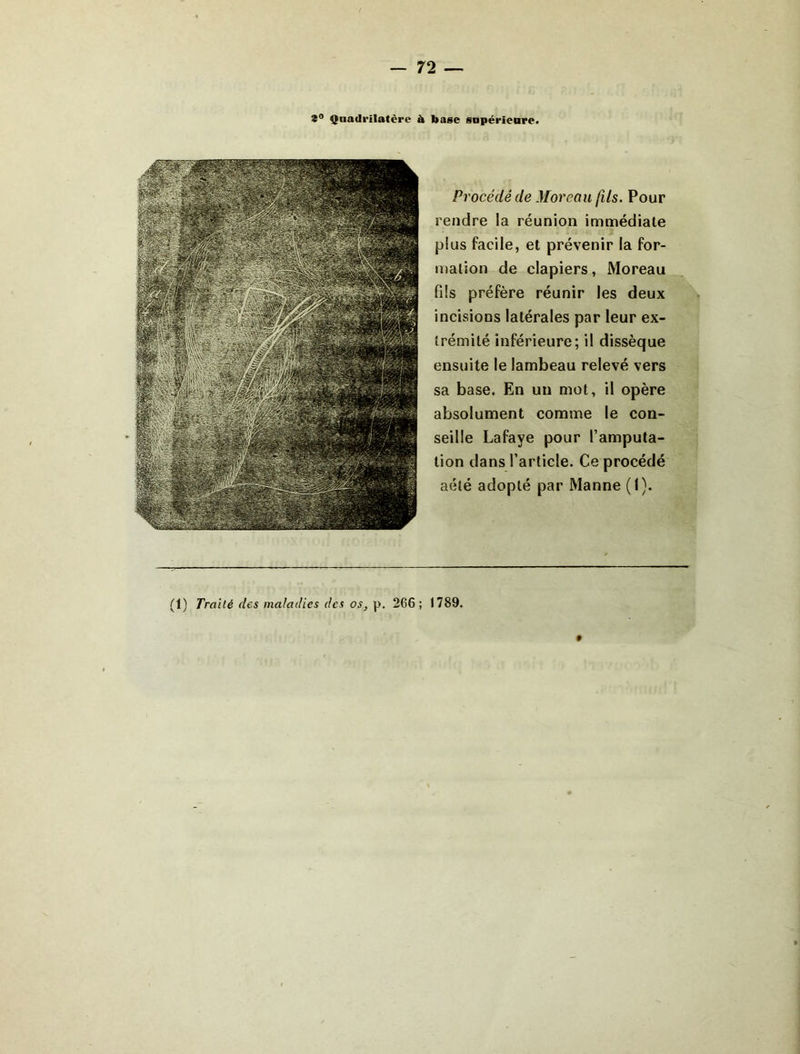 s** Quadrilatère à base snpérieore. Procédé de Moreau fils. Pour rendre la réunion immédiale plus facile, et prévenir la for- mation de clapiers, Moreau fils préfère réunir les deux incisions latérales par leur ex- trémité inférieure; il dissèque ensuite le lambeau relevé vers sa base. En un mot, il opère absolument comme le con- seille Lafaye pour l’amputa- tion dans l’article. Ce procédé aélé adopté par Manne (I). (1) Traité des maladies des os, p. 266; 1789. f