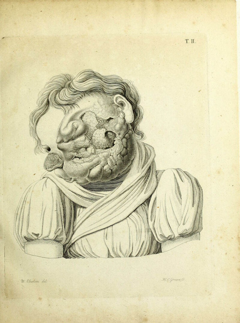 $ . C 6 e/(e in det- C(/ncl/o */£ t.h.