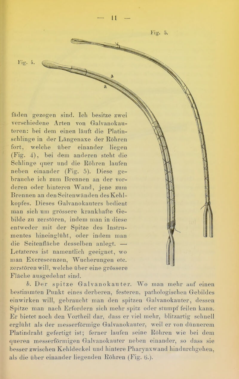 u !<>•. J. fäden g-ezogen sind. Icli besitze zwei verschiedene Arten von Gralvanokan- teren: bei dem einen länft die Platin- scblinge in der Längenaxe der Eobren fort, welche über einander liegen (Fig. 4), bei dem anderen steht die Schlinge (jner nnd die Röhren lanfen neben einander (Fig. 5). Diese brauche ich zum Brennen an der vor- deren oder hinteren Wand, jene zum Brennen an den Seitenwänden des Kehl- kopfes. Dieses Galvanokauters bedient man sich um grössere krankhafte Ge- bilde zu zerstören, indem man in diese enhveder mit der Spitze des Instru- mentes hineinglüht, oder indem man die Seitenfläche desselben anlegt. — Letzteres ist namentlich geeignet, avo man Excrescenzen, Wucherungen etc. zerstören Avill, welche über eine grössere Fläche ausgedehnt sind. h. Der spitze Galvanokauter. Wo man mehr auf einen bestimmten Punkt eines derberen, festeren, pathologischen Gebildes eiiiwu’rken will, gebraucht man den spitzen Galvanokauter, dessen Spitze man nach Erfordern sich mehr spitz oder stumpf feilen kann. Er bietet noch den Vortheil dar, dass er viel mehr, blitzartig schnell erglüht als der messerförmige Galvanokauter, Aveil er von dünnerem Platindraht gefertigt ist; ferner laiifen seine Röhren wie bei dem queren messerförmigen Galvanokauter neben einander, so dass sie besser zwischen Kehldeckel und hintere Pharynxwand hindurehgehen, als die über einander liegenden Röhren (Fig. fl.).