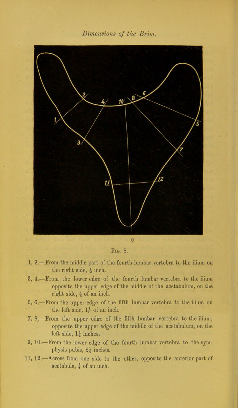 9 Fig. 8. 1, 2.—From the middle part of the fourth lumbar vertebra to the ilium on the right side, 5 inch. 3, 4.—From the lower edge of the fourth lumbar vertebra to the ilium opposite the upper edge of the middle of the acetabulum, on the right side, | of an inch. 5, 6,—From the upper edge of the fifth lumbar vertebra to the ilium on the left side, lg- of an inch. 7, 8,—From the upper edge of the fifth lumbar vertebra to the ilium, opposite the upper edge of the middle of the acetabulum, on the left side, inches. 9, 10.—From the lower edge of the fourth lumbar vertebra to the sym- physis pubis, 2^ inches. 11, 12.—Across from one side to the other, opposite the anterior part of acetabula, | of an inch.