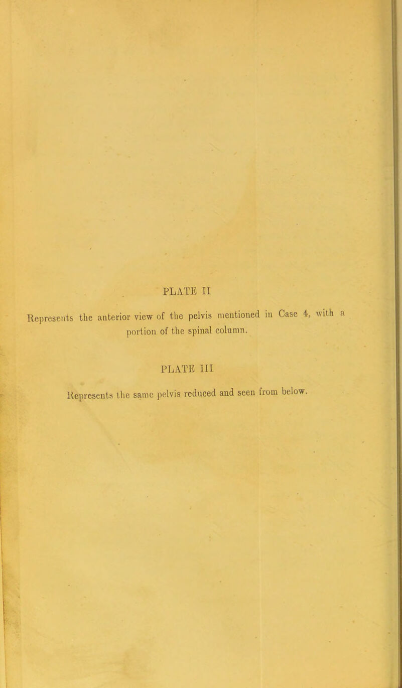 PLATE II Represents the anterior view of the pelvis mentioned in Case 4, with portion of the spinal column. PLATE III Represents the same pelvis reduced and seen from below.