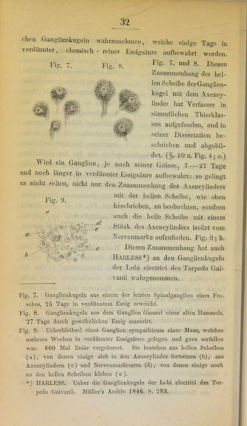 fluMi Ganglienkuoeln walirzimclinion, avcIcIic einige Tage in verdünnter, chemisch - reiner Essigsäure aufljcwalirt worden. Fig. 7. und 8. Diesen Fig. 7. Fio- Zusammenhang der hel- len Scheibe dcrGanglien- kugcl mit dem Axency- linder hat Verfasser in sämmtlichen Thierklas- sen aufgefunden, und in seiner Dissertation he- schriel)en und abgebil- det. (§. 10 u. Fig. 4; c.) AVird ein Ganglion, je nach seiner Grösse, 7 — 27 Tage und noch länger in verdünnter Essigsäure aufbewahrt; so gelingt es nicht selten, nicht nur den Zusammenhang des Axencylinders mit der hellen Scheibe, wie oben beschrieben, zu beobachten, sondern auch die helle Scheibe mit einem Stück des Axencylinders isolirt vom Nervenmarke aufzufiuden. Fig. 9 ; b. Diesen Zusammenhang hat auch HakleSS*) an den Ganglienkugcln der Lobi electrici des Torpedo Gal- Fig. 9. CU b- O) W.. (Ä>- ,;?V« ^ ^ vanii wahrgenommen. Fig. 7. Gangliciikugoln aus einem der letzten Spinalganglien eines Fro- sches, 25 Tage in verdünntem Essig erweicht. Fig. 8. Ganglienkugcln aus dem Ganglion Gasseri eines alten Hammels, 27 Tage durch gewöhnlichen Essig macerirt. Fig. 9. Uehcrbleibscl eines Ganglion syrapathicum einer Maus, welches mehrere Wochen in verdünnter Essigsäure gelegen und ganz zerfallen war. 600 Mal liniar vergrössert. Sie bestehen aus hellen Scheiben (a), von denen einige sich in den Axcncylinder fortsetzen (b), aus Axencylindern (c) und Nervenmark'rcsteu (d), von denen einige noch an den hellen Scheiben kleben ( e ). '*) HAHLESS. lieber die Ganglicnktigehi der Lobi electrici des Tor- jiedü Galvanii. Müllor’s Archiv 1846. S. 283.