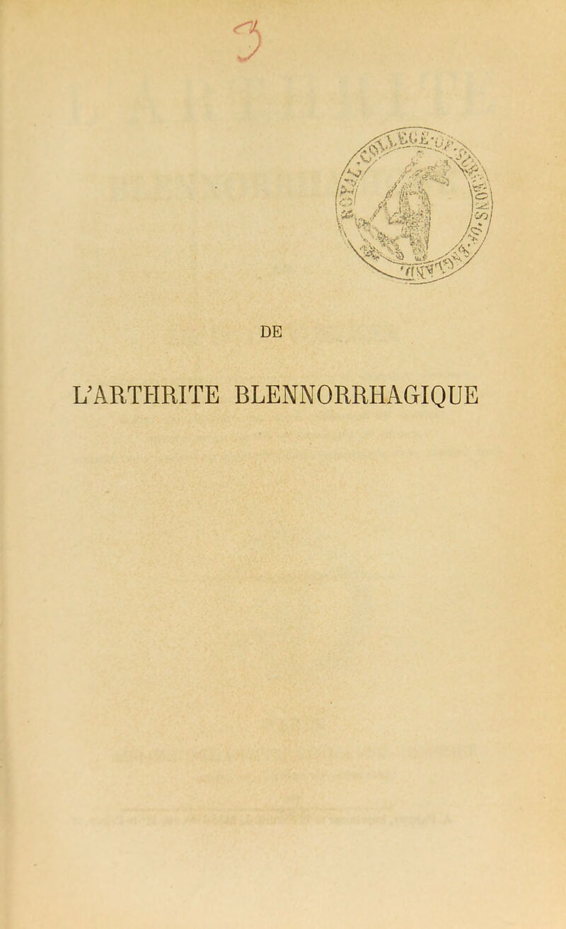 r J DE L’ARTHRITE BLENNORRHAGIQUE