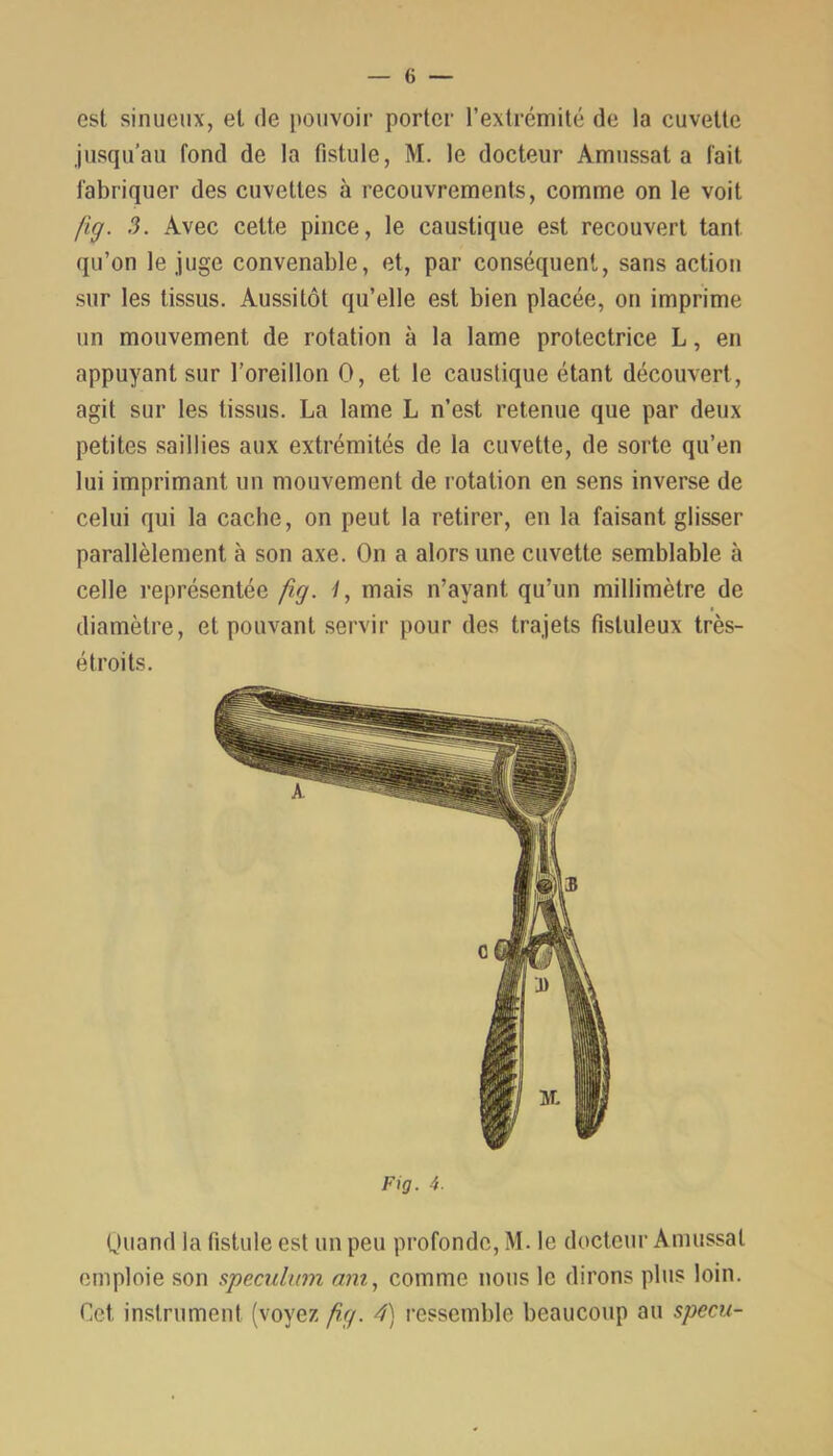 est sinueux, et de pouvoir porter l’extrémité de la cuvette jusqu’au fond de la fistule, M. le docteur Amussat a fait fabriquer des cuvettes à recouvrements, comme on le voit fig. 3. Avec cette pince, le caustique est recouvert tant qu’on le juge convenable, et, par conséquent, sans action sur les tissus. Aussitôt qu’elle est bien placée, on imprime un mouvement de rotation à la lame protectrice L, en appuyant sur l’oreillon O, et le caustique étant découvert, agit sur les tissus. La lame L n’est retenue que par deux petites saillies aux extrémités de la cuvette, de sorte qu’en lui imprimant un mouvement de rotation en sens inverse de celui qui la cache, on peut la retirer, en la faisant glisser parallèlement à son axe. On a alors une cuvette semblable à celle représentée fig. 1, mais n’ayant qu’un millimètre de diamètre, et pouvant servir pour des trajets fistuleux très- étroits. Fig. 4. Quand la fistule est un peu profonde, M. le docteur Amussat emploie son spéculum am, comme nous le dirons plus loin. Cet instrument (voyez fig. 4) ressemble beaucoup au specu-