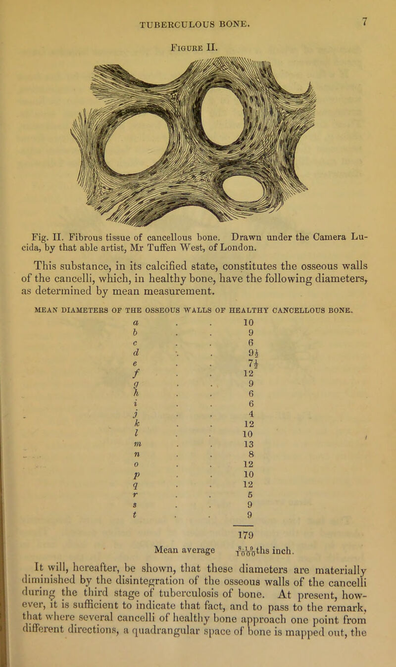 Figure II. Fig. II. Fibrous tissue of cancellous bone. Drawn under the Camera Lu- cida, by that able artist, Mr TufFen West, of London. This substance, in its calcified state, constitutes the osseous walls of the cancelli, which, in healthy bone, have the following diameters, as determined by mean measurement. MEAN DIAMETERS OF THE OSSEOUS WALLS OF HEALTHY CANCELLOUS BONE. a b c d e f 9 h i 5 k I m n 0 P 9 r s 10 9 6 12 9 6 6 4 12 10 13 8 12 10 12 6 9 t 9 i 179 Mean average yVoofi'® inch. It vyill, hereafter, be shown, that these diameters are materially dimini.shed by the disintegration of the osseous walls of the cancelli during the third stage of tuberculosis of bone. At present, how- ever, it is sufficient to indicate that fact, and to pass to the remark, that where .several cancelli of healthy bone approach one point from different directions, a quadrangular space of bone is mapped out, the