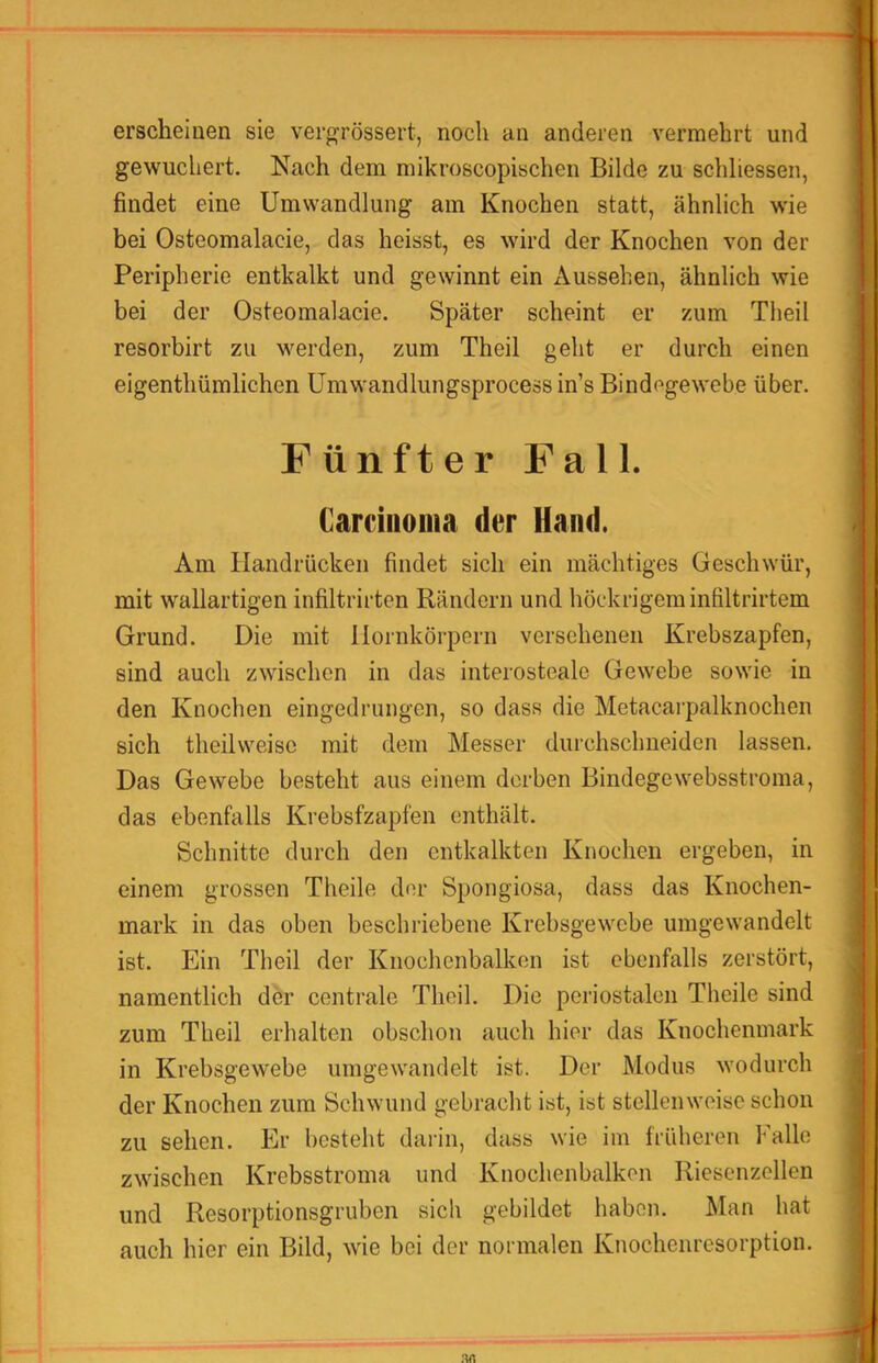 erscheinen sie vergTössert, noch an anderen vermehrt und gewuchert. Nach dem mikroscopischen Bilde zu schliessen, findet eine Umwandlung am Knochen statt, ähnlich wie bei Osteomalacie, das heisst, es wird der Knochen von der Peripherie entkalkt und gewinnt ein Aussehen, ähnlich wie bei der Osteomalacie. Später scheint er zum Theil resorbirt zu werden, zum Theil geht er durch einen eigenthümlichen Umwandlungsprocessin’s Bindegewebe über. Fünfter Fall. Carcinoma der Hand. Am Handrücken findet sich ein mächtiges Geschwür, mit wallartigen infiltrirten Rändern und höckrigem infiltrirtem Grund. Die mit llornkörpern versehenen Krebszapfen, sind auch zwischen in das interostealc Gewebe sowie in den Knochen eingedrungen, so dass die Metacarpalknochen sich theilvveisc mit dem Messer durchschneiden lassen. Das Gewebe besteht aus einem derben Bindegewebsstroma, das ebenfalls Krebsfzapfen enthält. Schnitte durch den entkalkten Knochen ergeben, in einem grossen Theile der Spongiosa, dass das Knochen- mark in das oben beschriebene Krebsgewebe umgewandelt ist. Ein Theil der Knochenbalken ist ebenfalls zerstört, namentlich der centrale Theil. Die periostalen Theile sind zum Theil erhalten obschon auch hier das Knochenmark in Krebsgewebe umgewandclt ist. Der Modus wodurch der Knochen zum Schwund gebracht ist, ist stellenweise schon zu sehen. Er besteht darin, dass wie im früheren Falle zwischen Krebsstroma und Knochenbalkon Riesenzellen und Resorptionsgruben sich gebildet haben. Man hat auch hier ein Bild, wie bei der normalen Knochenresorption.