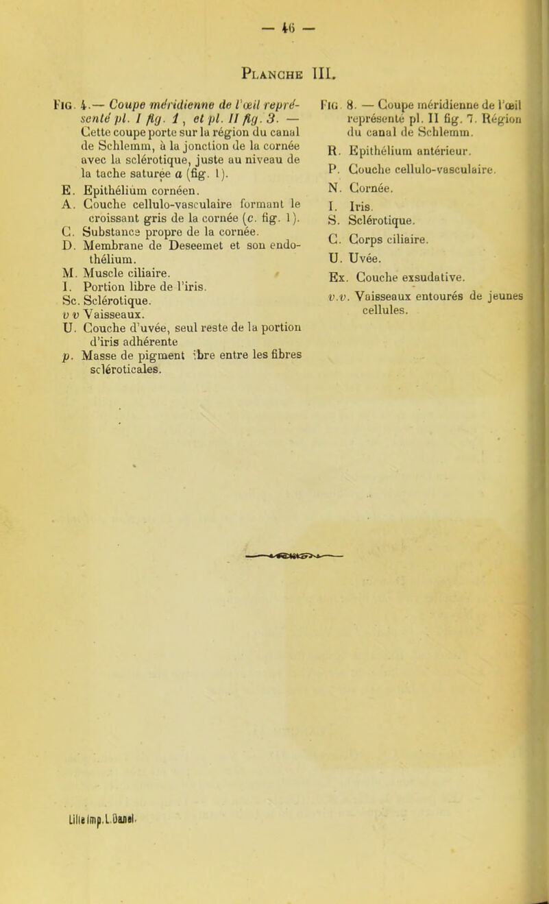 - 4() - PlANCHE III. Fig 4.— Coupe mdridienne de l'œil repré- scnlé pl. I ft(j. 1, et pl. II fkj. 3. — Cette coupe porte sur la région du canal de Schleinm, à la jonction de la cornée avec la sclérotique, juste au niveau de la tache saturée a (fig. 1). E. Epithélium cornéen. A. Couche cellulo-vasculaire formant le croissant gris de la cornée (c. fig. 1 ). C. Substance propre de la cornée. D. Membrane de Deseemet et son endo- thélium. M. Muscle ciliaire. 1. Portion libre de l’iris. Sc. Sclérotique. V V Vaisseaux. U. Couche d’uvée, seul reste de la portion d’iris adhérente p. Masse de pigment ibre entre les fibres scléroticales. Fig 8. — Coupe méridienne de l’cnil représenté pl. II fig. 1. Région du canal de Sc.hlemm. R. Epithélium antérieur. P. Couche cellulo-vasculaire. N. Cornée. I. Iris. S. Sclérotique. C. Corps ciliaire. U. Uvée. Ex. Couche exsudative. v.v. Vaisseaux entourés de jeunes cellules. Lille Imp.lüuii.