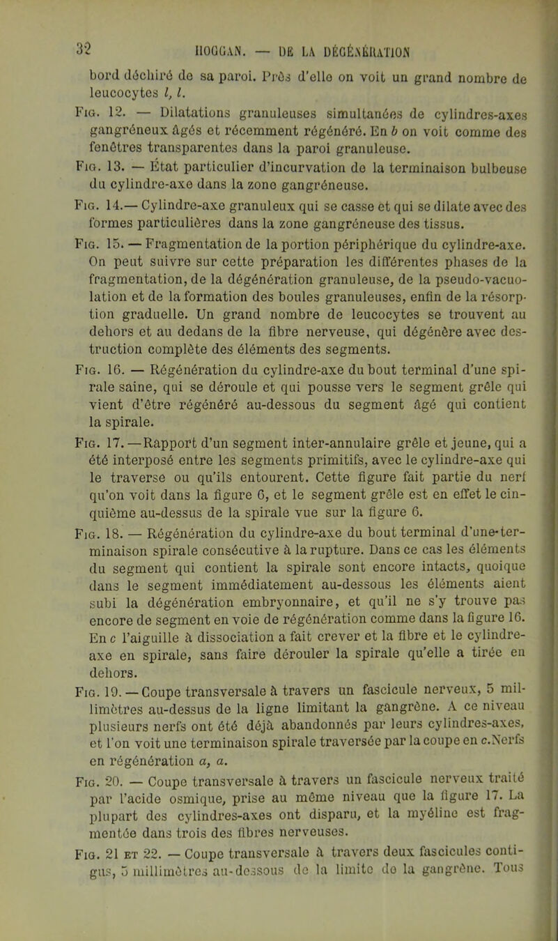 bord déchiré de sa paroi. Prés d’ello on voit un grand nombre de leucocytes l, l. Fig. 12. — Dilatations granuleuses simultanées de cylindres-axes gangréneux âgés et récemment régénéré. En b on voit comme des fenêtres transparentes dans la paroi granuleuse. Fio. 13. — État particulier d’incurvation do la terminaison bulbeuse du cylindre-axe dans la zone gangréneuse. Fig. 14.— Cylindre-axe granuleux qui se casse et qui se dilate avec des formes particulières dans la zone gangréneuse des tissus. Fig. 15. — Fragmentation de la portion périphérique du cylindre-axe. On peut suivre sur cette préparation les différentes phases do la fragmentation, de la dégénération granuleuse, de la pseudo-vacuo- lation et de la formation des boules granuleuses, enfin de la résorp- tion graduelle. Un grand nombre de leucocytes se trouvent au dehors et au dedans de la fibre nerveuse, qui dégénère avec des- truction complète des éléments des segments. Fig. 16. — Régénération du cylindre-axe du bout terminal d’une spi- rale saine, qui se déroule et qui pousse vers le segment grêle qui vient d’être régénéré au-dessous du segment âgé qui contient la spirale. Fig. 17.—Rapport d’un segment inter-annulaire grêle et jeune, qui a été interposé entre les segments primitifs, avec le cylindre-axe qui le traverse ou qu’ils entourent. Cette figure fait partie du nerf qu’on voit dans la figure G, et le segment grêle est en effet le cin- quième au-dessus de la spirale vue sur la figure 6. Fig. 18. — Régénération du cylindre-axe du bout terminal d’une-ter- minaison spirale consécutive à la rupture. Dans ce cas les éléments du segment qui contient la spirale sont encore intacts, quoique dans le segment immédiatement au-dessous les éléments aient subi la dégénération embryonnaire, et qu’il ne s’y trouve pas encore de segment en voie de régénération comme dans la figure 16. En c l’aiguille â dissociation a fait crever et la fibre et le cylindre- axe en spirale, sans faire dérouler la spirale qu’elle a tirée en dehors. Fig. 19. —Coupe transversale à travers un fascicule nerveux, 5 mil- limètres au-dessus de la ligne limitant la gangrène. A ce niveau plusieurs nerfs ont été déjà abandonnés par leurs cylindres-axes, et l’on voit une terminaison spirale traversée par la coupe en c.Nerfs en régénération a, a. Fig. 20. — Coupe transversale à travers un fascicule nerveux traité par l’acide osmique, prise au même niveau que la figure 17. La plupart des cylindres-axes ont disparu, et la myéline est frag- mentée dans trois des libres nerveuses. Fig. 21 et 22. — Coupe transversale à travers deux fiiscicules conti- gus, 5 millimètres au-dessous do la limite do la gangrène. Tous