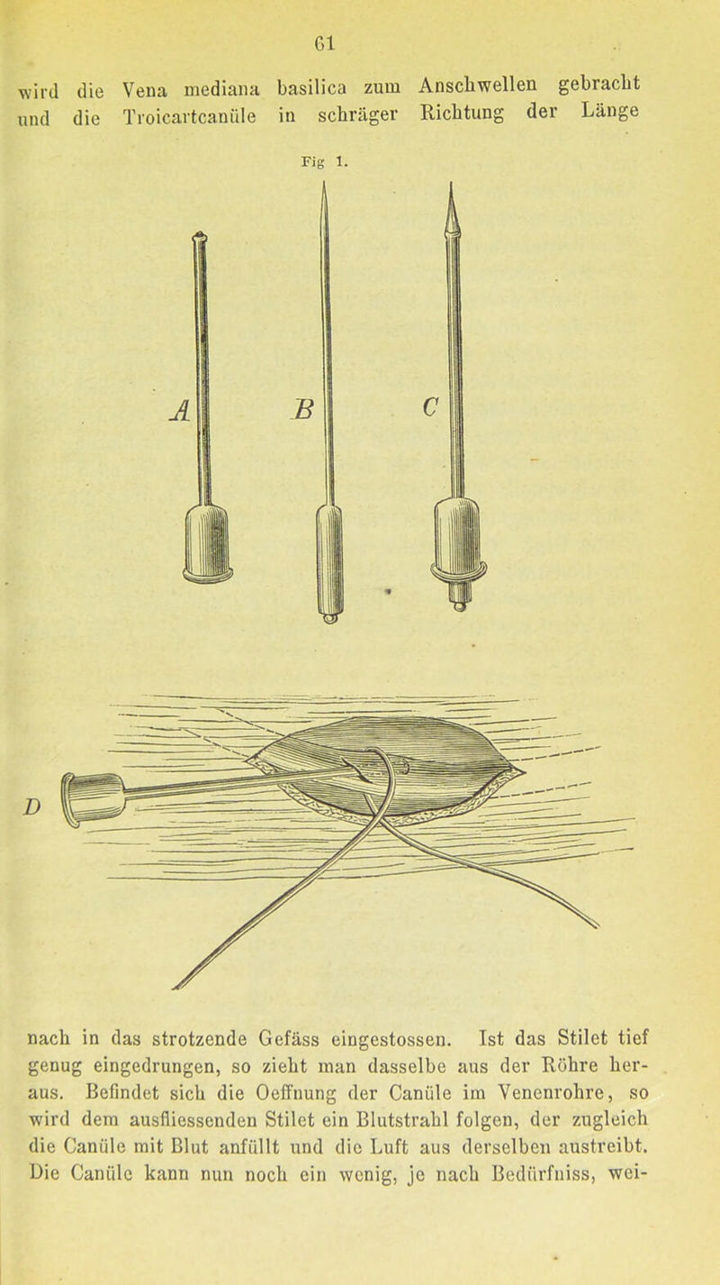 Gl wird die Vena mediana basilica zum Anscliwellen gebracht und die Troicartcanüle in schräger Richtung der Länge nach in das strotzende Gefäss eingestossen. Ist das Stilet tief genug eingedrungen, so zieht man dasselbe aus der Röhre her- aus. Befindet sich die Oeffnung der Canüle im Venenrohre, so wird dem ausfiiessenden Stilet ein Blutstrahl folgen, der zugleich die Canüle mit Blut anfüllt und die Luft aus derselben austreibt. Die Canüle kann nun noch ein wenig, je nach Bedürfniss, wei-
