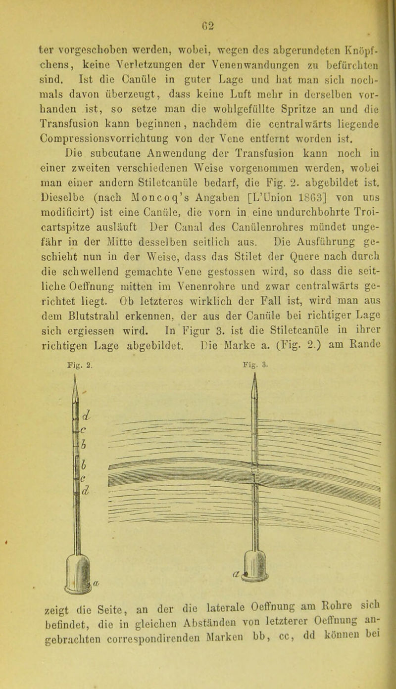 fi2 4 tev vorgeschoben werden, wobei, wogen dos abgerundeten Knöpf- ll chens, keine Verletzungen der Venenwandungen zu befürcliten I sind. Ist die Canüle in guter Lage und liat man sich noeb- nials davon überzeugt, dass keine Luft mehr in derselben vor- handen ist, so setze man die wohlgefüllte Spritze an und die Transfusion kann beginnen, nachdem die centralwärts liegende Compressionsvorrichtung von der Vene entfernt worden ist. Die subcutane Anwendung der Transfusion kann noch in j einer zweiten verschiedenen Weise vorgenoramen werden, wobei man einer andern Stiletcanüle bedarf, die Fig. 2. abgebildet ist. Dieselbe (nach Moncoq’s Angaben [L’ünion 18G3] von uns raodificirt) ist eine Canüle, die vorn in eine undurchbohrte Troi- cartspitze ausläuft Der Canal des Canülenrohres mündet unge- fähr in der Mitte desselben seitlich aus. Die Ausführung ge- schieht nun in der Weise, dass das Stilet der Quere nach durch die schwellend gemachte Vene gestossen wird, so dass die seit- liche Oeffnung mitten ira Venenrohre und zwar centralwärts ge- richtet liegt. Ob letzteres wirklich der Fall ist, wird man aus dem ßlutstrahl erkennen, der aus der Canüle bei richtiger Lage sich ergiessen wird. In Figur 3. ist die Stiletcanüle in ihrer richtigen Lage abgebildet. Die Marke a. (Fig. 2.) am Rande Fig. 2. Fig. 3. zeigt die Seite, an der die laterale Oeffnung am Rohre sich befindet, die in gleichen Abständen von letzterer Oeffnung an- gebrachten correspondirendeu Marken bb, cc, dd können bei