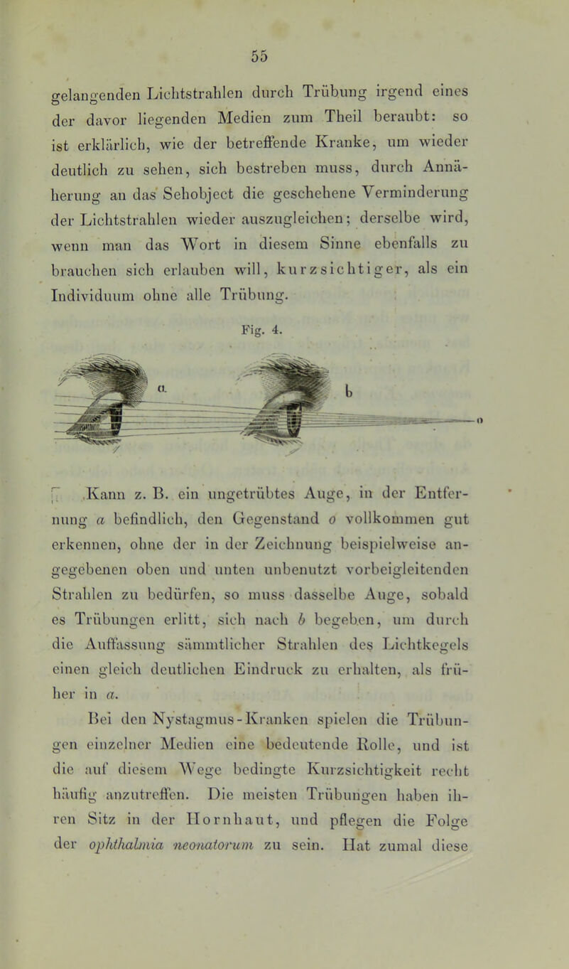 crelauo-enden Lichtstrahlen durch Trübung irgend eines der davor liegenden Medien zum Theil beraubt: so ist erklärlich, wie der betreflfende Kranke, um wieder deutlich zu sehen, sich bestreben muss, durch Annä- herung an das Sehobject die geschehene Verminderung der Lichtstrahlen wieder auszugleichen; derselbe wird, wenn man das Wort in diesem Sinne ebenfalls zu brauchen sich erlauben will, kurzsichtiger, als ein Individuum ohne alle Trübung. Fig. 4. IT .Kann z. B. ein ungetrübtes Auge, in der Entfer- nung a befindlich, den Gegenstand o vollkommen gut erkennen, ohne der in der Zeichnung beispielweiso an- gegebenen oben und unten unbenutzt vorbeigleitenden Strahlen zu bedürfen, so muss dasselbe Auge, sobald es Trübungen erlitt, sich nach h begeben, um durch die Auftässung sämmtlicher Strahlen des Lichtkegels einen gleich deutlichen Eindruck zu erhalten, als frü- her in rt. ’ Bei den Nystagmus-Ki'anken spielen die Trübun- gen einzelner Medien eine bedeutende Rolle, und ist die auf diesem Wege bedingte Kurzsichtigkeit recht häufig anzutreffen. Die meisten Trübungen haben ih- ren Sitz in der Hornhaut, und pflegen die Folge der Ophthalmia neonatorum zu sein. Hat zumal diese