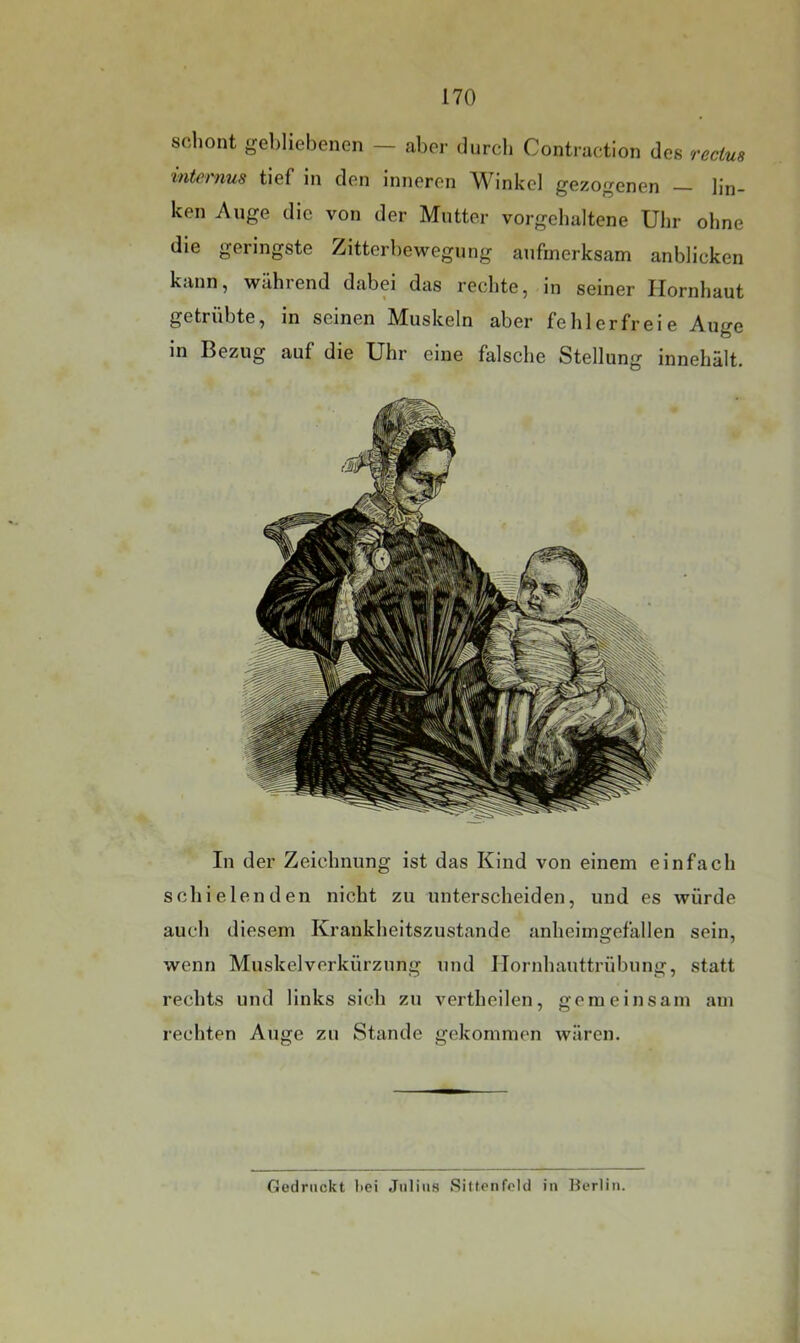 schont gebliebenen — aber durch Contraction des recius internus tief in den inneren Winkel gezogenen — lin- ken Auge die von der Mutter vorgehaltene Uhr ohne die geringste Zitterbewegung aufmerksam anblicken kann, während dabei das rechte, in seiner Hornhaut getrübte, in seinen Muskeln aber fehlerfreie Auge in Bezug auf die Uhr eine falsche Stellung innehält. In der Zeichnung ist das Kind von einem einfach schielenden nicht zu unterscheiden, und es würde auch diesem Krankheitszustande anheimgefallen sein, wenn Muskel Verkürzung und Hornhauttrübung, statt rechts und links sich zu vertheilen, gemeinsam am rechten Auge zu Stande gekommen wären. Gedruckt liei Julius Sittenfold iii Uerliii.