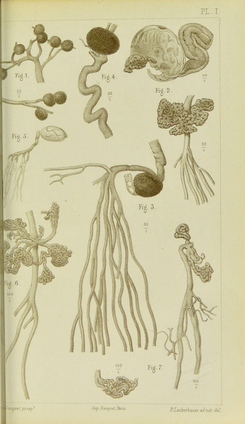 PL.I. Jmp .Becqual.Jkx'is ucqu&l ptùep P.Xàd{erhmeT àdnai del.