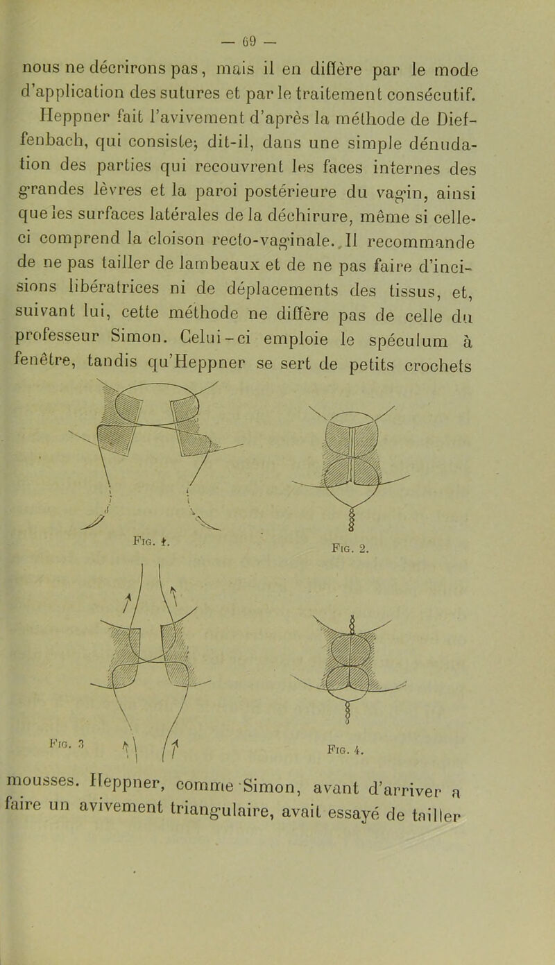 nous ne décrirons pas, mais il en diffère par le mode d’application des sutures et par le traitement consécutif. Heppner fait l’avivement d’après la méthode de Dief- fenbach, qui consiste; dit-il, dans une simple dénuda- tion des parties qui recouvrent les faces internes des grandes lèvres et la paroi postérieure du vag'in, ainsi que les surfaces latérales de la déchirure, même si celle- ci comprend la cloison recto-vag'inale. 11 recommande de ne pas tailler de lambeaux et de ne pas faire d’inci- sions libératrices ni de déplacements des tissus, et, suivant lui, cette méthode ne diffère pas de celle du professeur Simon. Celui-ci emploie le spéculum à fenêtre, tandis qu’Heppner se sert de petits crochets Fig. t. Fig. 2. mousses. Heppner, comme Simon, avant d’arri faire un avivement triangulaire, avait essayé de 1 mon, avant cl arriver a e, avait essayé de tuilier