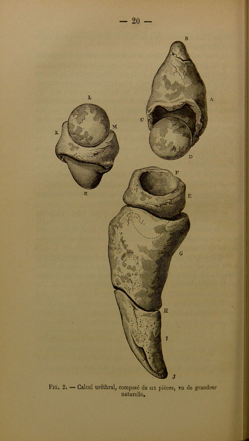 Fig. 2. — Calcul uréthral^ composé de six pièces, tu de grandeur naturelle.