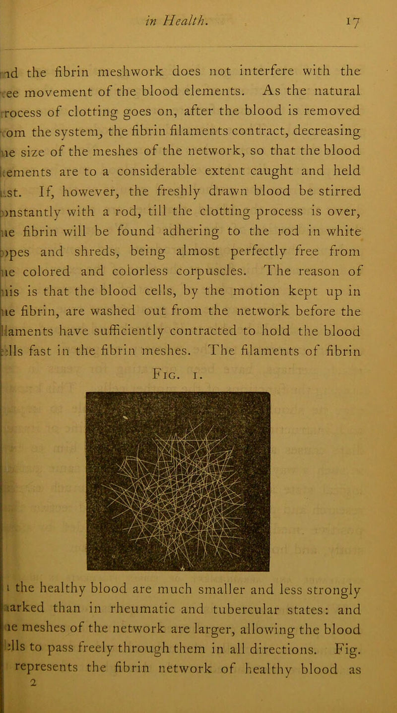 in Health. !id the fibrin meshwork does not interfere with the • ee movement of the blood elements. As the natural rocess of clotting goes on, after the blood is removed fcom the system^ the fibrin filaments contract, decreasing ue size of the meshes of the network, so that the blood i^ements are to a considerable extent caught and held ^:.st. If, however, the freshly drawn blood be stirred t))nstantly with a rod, till the clotting process is over, n.ie fibrin will be found adhering to the rod in white topes and shreds, being almost perfectly free from ^,ie colored and colorless corpuscles. The reason of uis is that the blood cells, by the motion kept up in lie fibrin, are washed out from the network before the llaments have sufficiently contracted to hold the blood :ills fast in the fibrin meshes. The filaments of fibrin Fig. I. i I the healthy blood are much smaller and less strongly parked than in rheumatic and tubercular states: and le meshes of the network are larger, allowing the blood i fils to pass freely through them in all directions. Fig. represents the fibrin network of healthy blood as 2