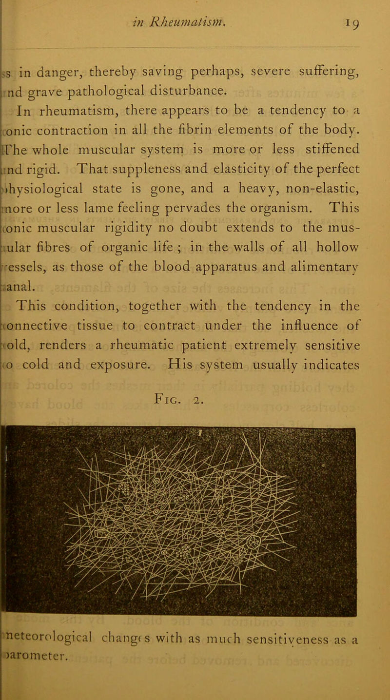 in Rheumatism, -s in danger, thereby saving perhaps, severe suffering, nd grave pathological disturbance. In rheumatism, there appears to be a tendency to a onic contraction in all the fibrin elements of the body. iFhe whole muscular system is more or less stiffened . nd rigid. That suppleness and elasticity of the perfect >hysiological state is gone, and a heavy, non-elastic, note or less lame feeling pervades the organism. This honic muscular rigidity no doubt extends to the mus- ^ ular fibres of organic life ; in the walls of all hollow ‘•'essels, as those of the blood apparatus and alimentary ^ anal. This condition, together with the tendency in the Connective tissue to contract under the influence of '■old, renders a rheumatic patient extremely sensitive ■ 0 cold and exposure. His system usually indicates [ Fig. 2. ■ neteorological changis with as much sensitiveness as a ^ larometer.