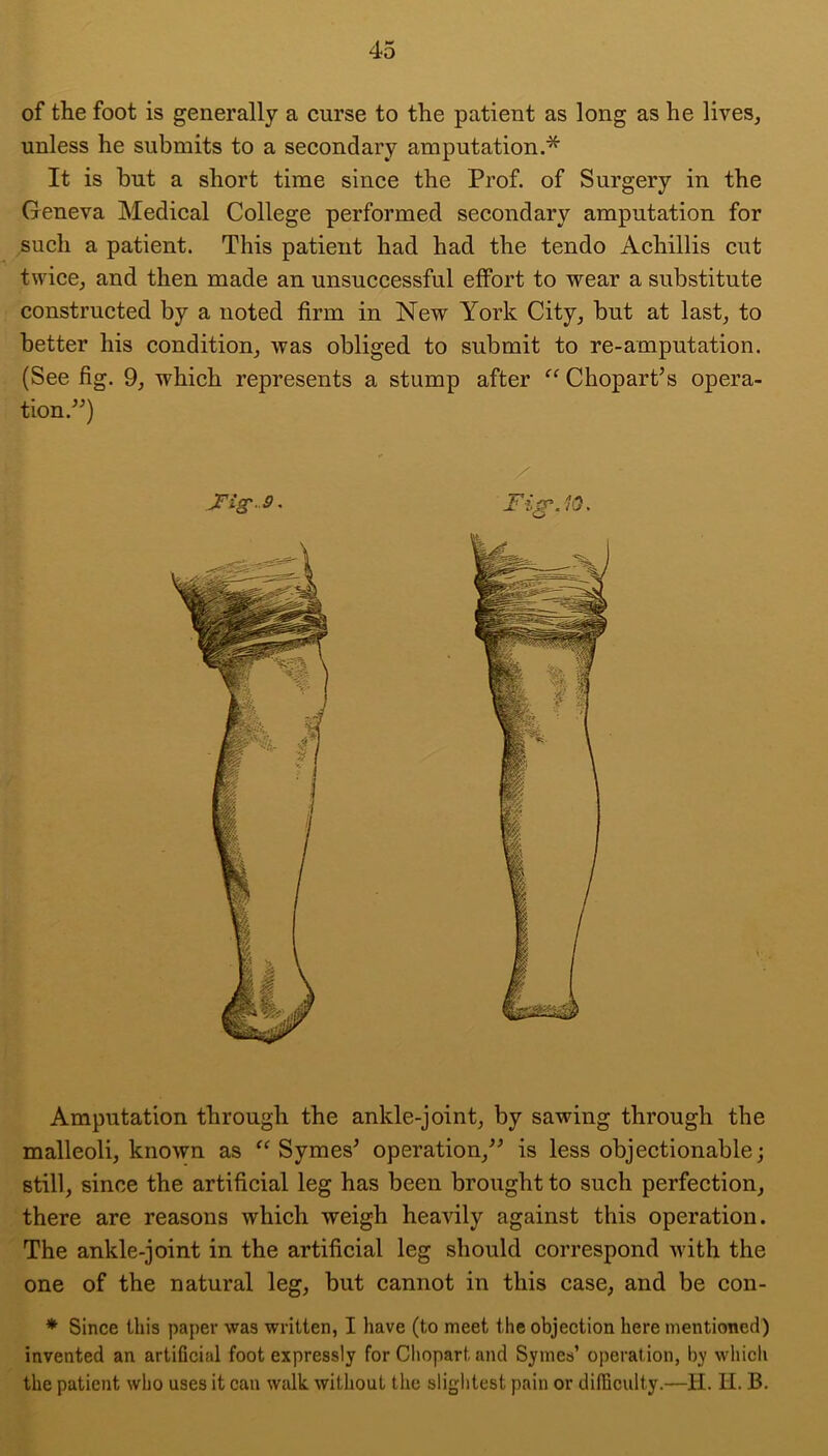 of the foot is generally a curse to the patient as long as he lives, unless he submits to a secondary amputation.* It is but a short time since the Prof, of Surgery in the Geneva Medical College performed secondary amputation for such a patient. This patient had had the tendo Achillis cut twice, and then made an unsuccessful effort to wear a substitute constructed by a noted firm in New York City, but at last, to better his condition, was obliged to submit to re-amputation. (See fig. 9, which represents a stump after ChoparPs opera- tion.^'’) X Amputation through the ankle-joint, by sawing through the malleoli, known as Symes^ operation,^^ is less objectionable; still, since the artificial leg has been brought to such perfection, there are reasons which weigh heavily against this operation. The ankle-joint in the artificial leg should correspond with the one of the natural leg, but cannot in this case, and be con- * Since this paper was written, I have (to meet the objection here mentioned) invented an artiflcial foot expressly for Cliopart and Symes’ operation, by which the patient who uses it can walk, without the slightest pain or difficulty.—H. H. B.