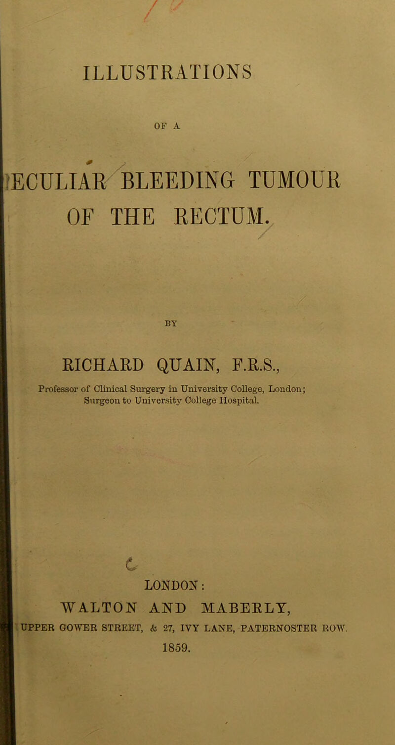 OF A llECULIAR BLEEDING TUMOUR OF THE RECTUM^ BY RICHARD QUAIN, F.R.S., Professor of Clinical Surgery in University College, Loudon; Surgeon to University College Hospital. LONDON: WA.LTON AND MABERLY, UPPER GOWER STREET, & 27, IVY LANE, PATERNOSTER ROW. 1859.