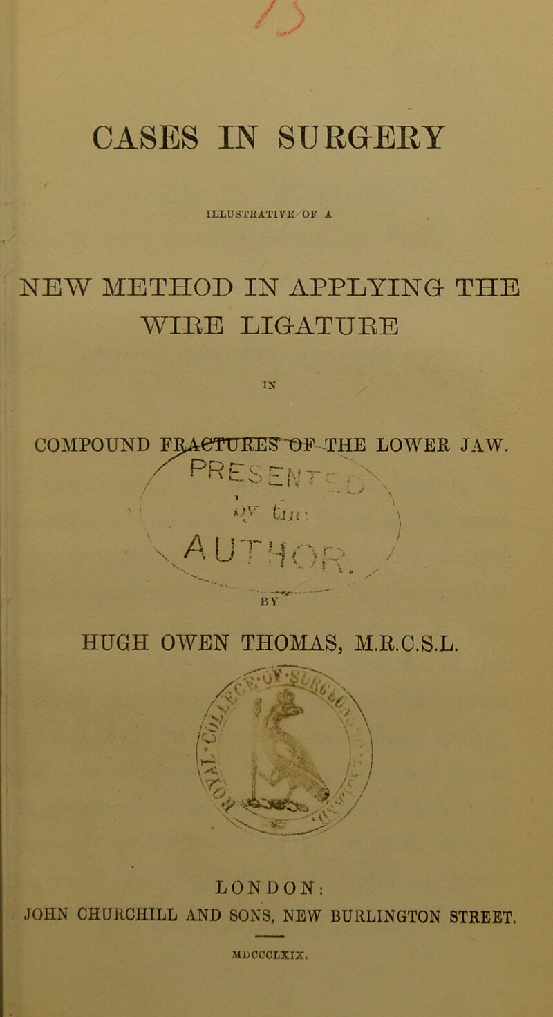 ILLUSTRATIVE OF A NEW METHOD IN APPLYING THE WIPE LIGATURE COMPOUND FJAerUEES^'' THE LOWER JAW. .-'^PRES - I'.n-' ,-X ' tiJC \ X A Li I HOfv BY HUGH OWEN THOMAS, M.R.C.S.L. LONDON: JOHN CHUIICHILL AND SONS, NEW BURLINGTON STREET. MDCCCLXIX.