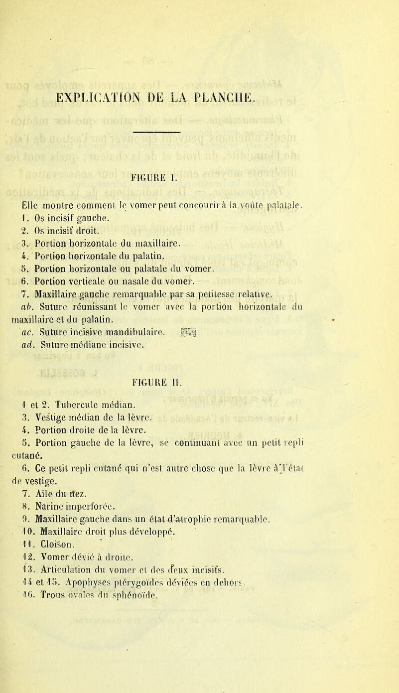 FIGURE I. Elle montre comment le vomer peut concourir à la voûte palatale. 1. Os incisif gauche. 2. Os incisif droit. 3. Portion horizontale du maxillaire. 4. Portion horizontale du palatin. 5. Portion horizontale ou palatale du vomer. 6. Portion verticale ou nasale du vomer. 7. Maxillaire gauche remarquable par sa pcLiiesse relative. ab. Suture réunissant le vomer avec la portion horizontale du maxillaire et du palatin. ac. Suture incisive mandibulaire. j$E§ ad. Suture médiane incisive. FIGURE 11. 1 et 2. Tubercule médian. 3. Vestige médian de la lèvre. 4. Portion droite de la lèvre. 5. Portion gauche de la lèvre, se continuant avec un petit repli cutané. 6. Ce petit repli cutané qui n’est, autre chose que la lèvre à*l’état de vestige. 7. Aile du rîez. 8. Narine impcrforéc. 0. Maxillaire gauche dans un état d’atrophie remarquable. 10. Maxillaire droit plus développé. 11. Cloi§on. 12. Vomer dévié à droite. 13. Articulation du vomer et des cfeux incisifs. 14 et 45. Apophyses ptérygoïdes déviées en dehors 16. Trous ovales du sphénoïde.