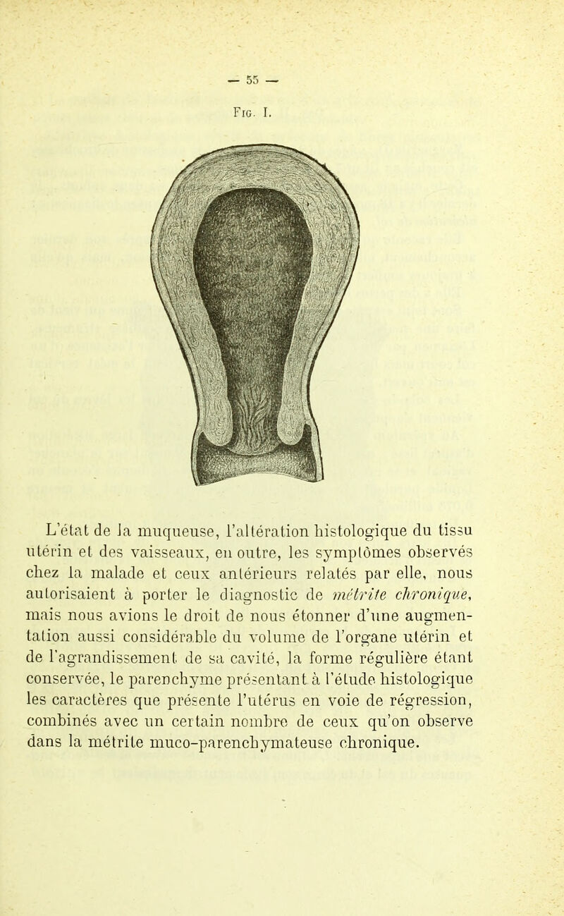 Fig. I. L’état de Ja muqueuse, l’altération histologique du tissu utérin et des vaisseaux, en outre, les symptômes observés chez la malade et ceux antérieurs relatés par elle, nous autorisaient à porter le diagnostic de métrite chronique, mais nous avions le droit de nous étonner d’une augmen- tation aussi considérable du volume de l’organe utérin et de l’agrandissement de sa cavité, la forme régulière étant conservée, le parenchyme présentant à l’étude histologique les caractères que présente l’utérus en voie de régression, combinés avec un certain nombre de ceux qu’on observe dans la métrite muco-parenchymateuse chronique.